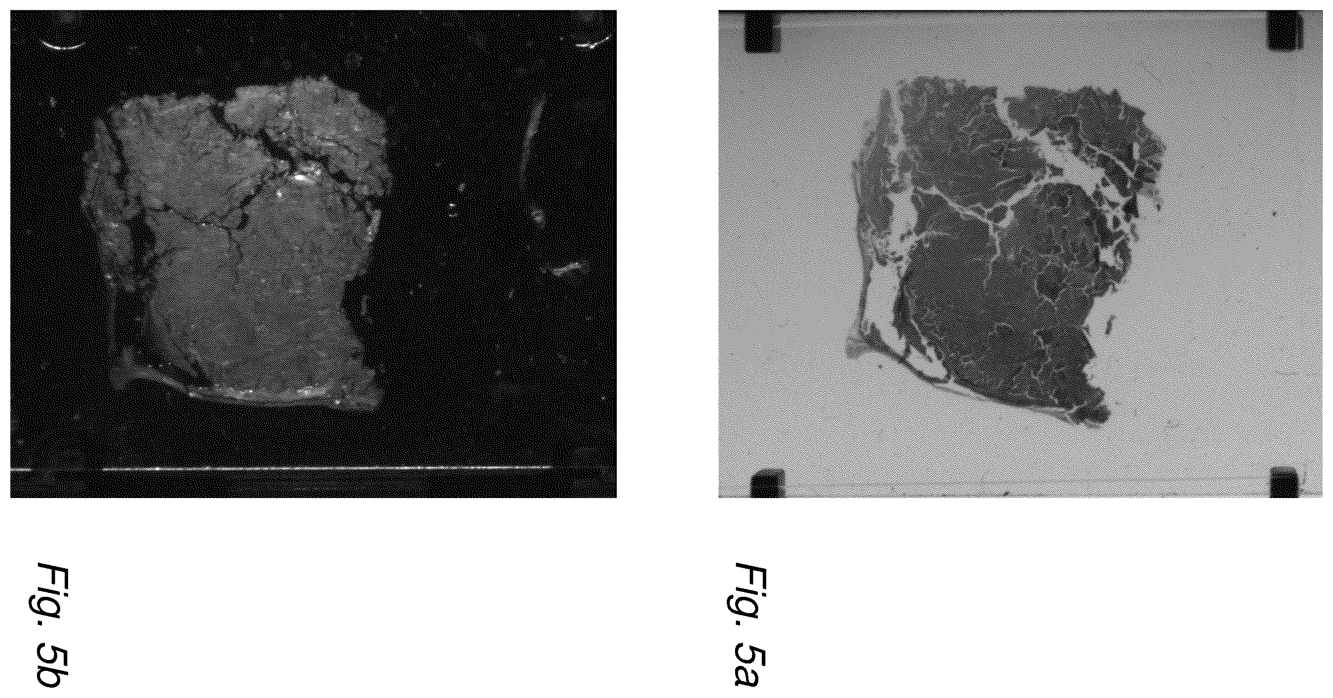 Patent US12579604 Figure 6 – Image registration with application in tissue treatment