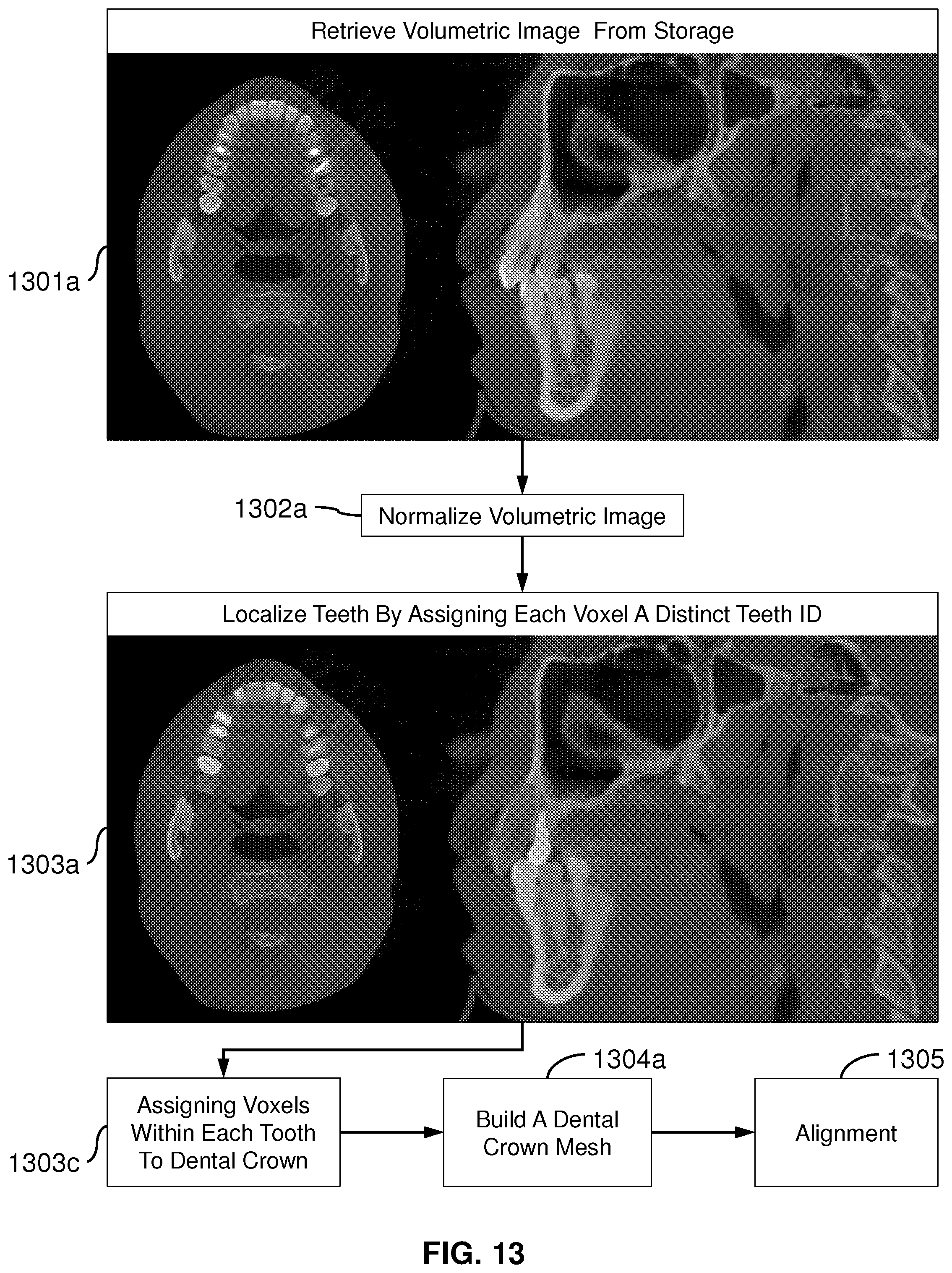 Patent US12579639 Figure 17 – System and method for fusion of volumetric and surface scan images