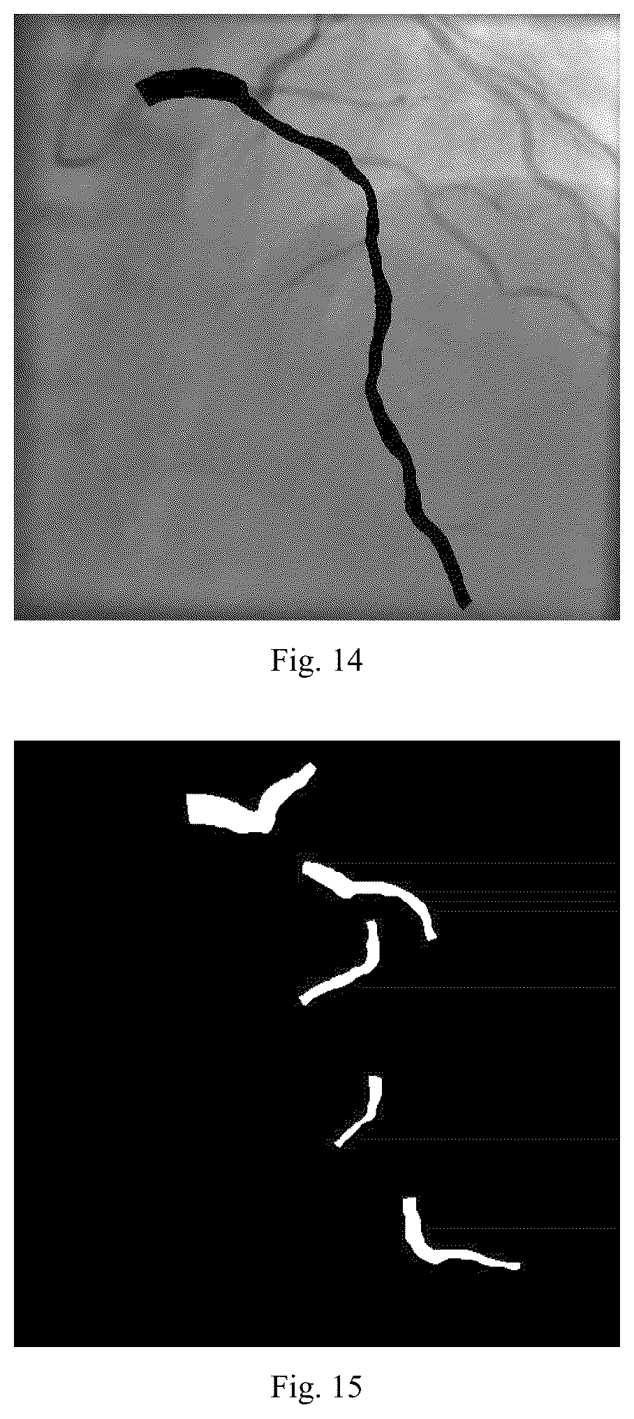 Patent US12579640 Figure 9 – Training method and apparatus for angiography image processing, and automatic processing method and apparatus
