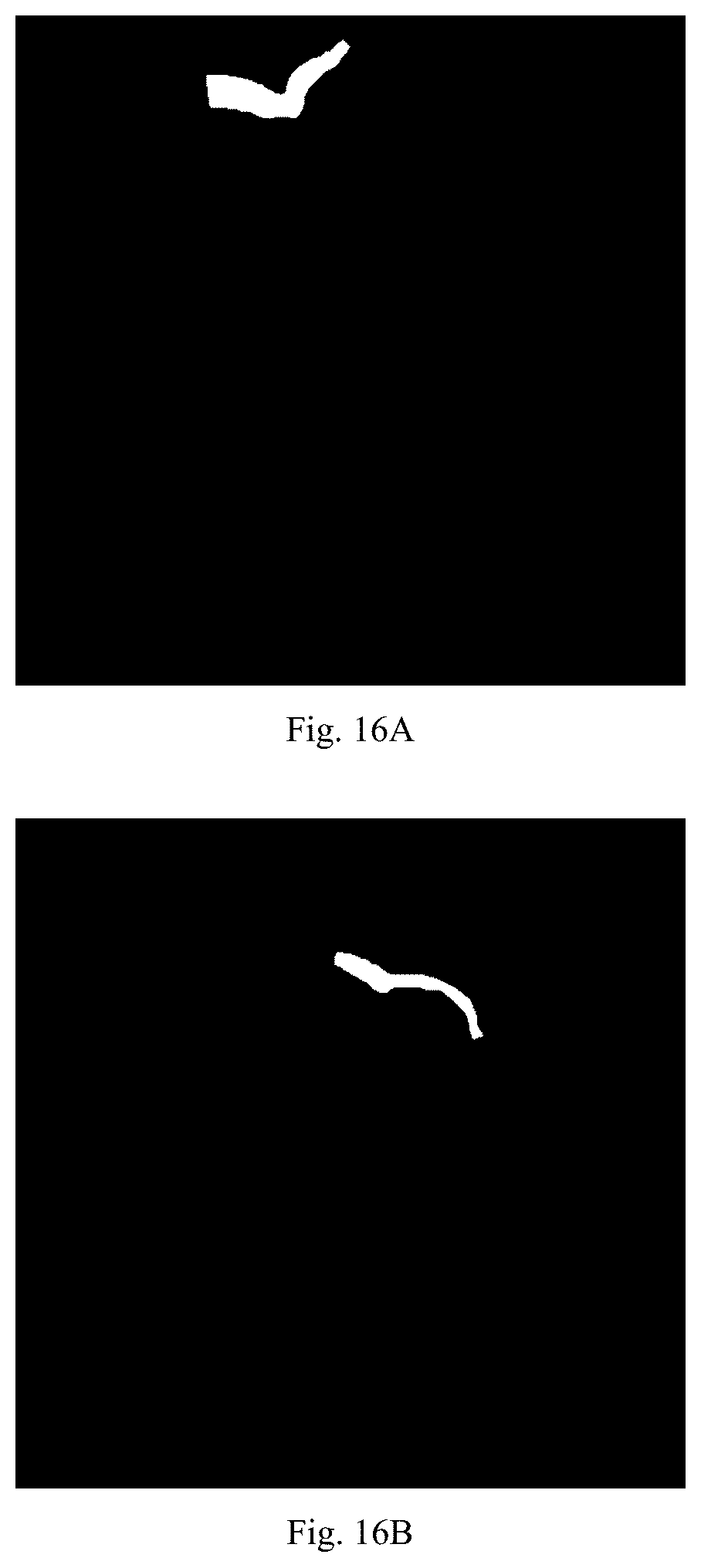 Patent US12579640 Figure 10 – Training method and apparatus for angiography image processing, and automatic processing method and apparatus