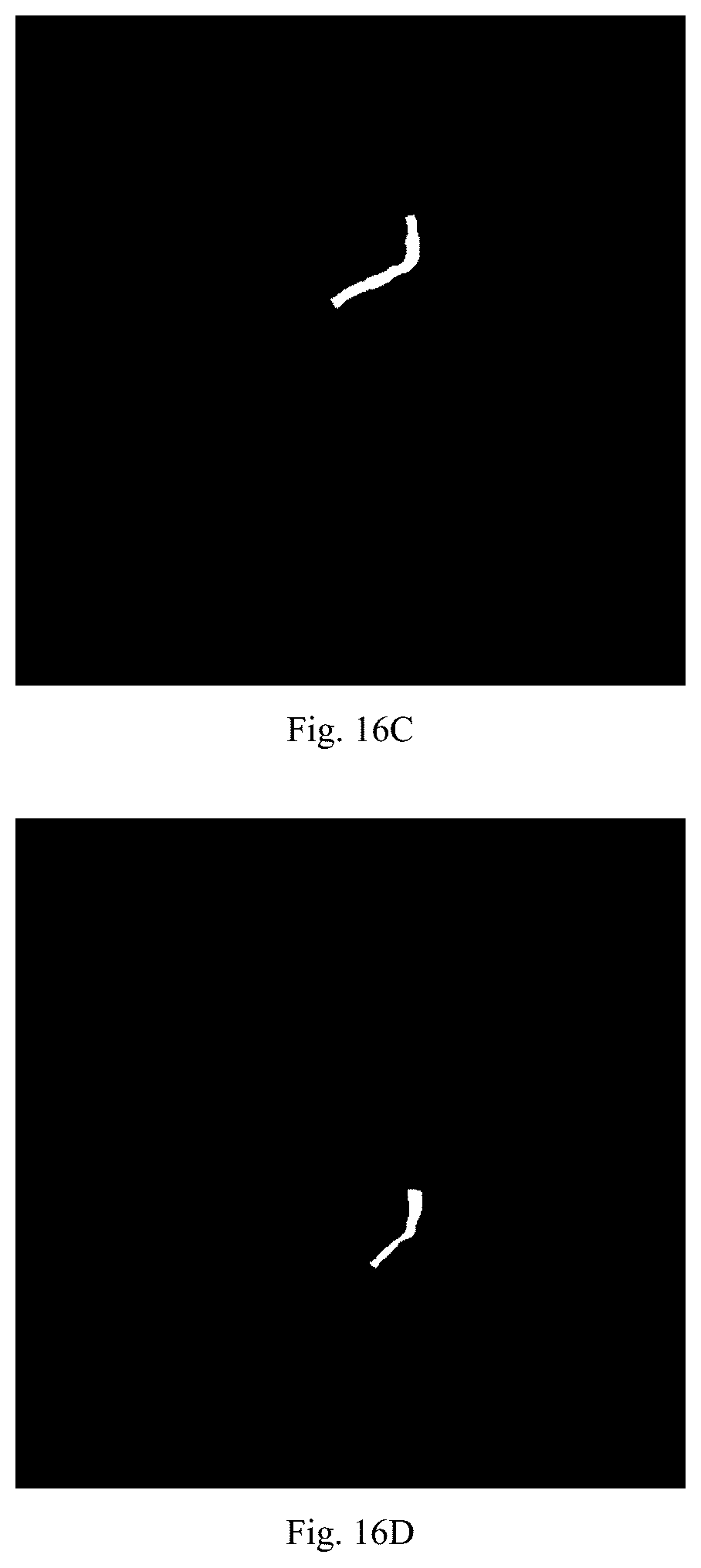 Patent US12579640 Figure 11 – Training method and apparatus for angiography image processing, and automatic processing method and apparatus