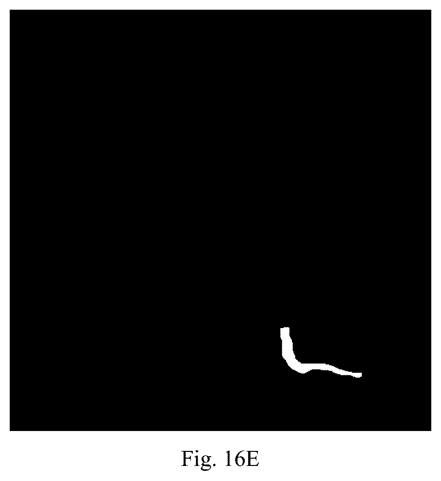 Patent US12579640 Figure 12 – Training method and apparatus for angiography image processing, and automatic processing method and apparatus