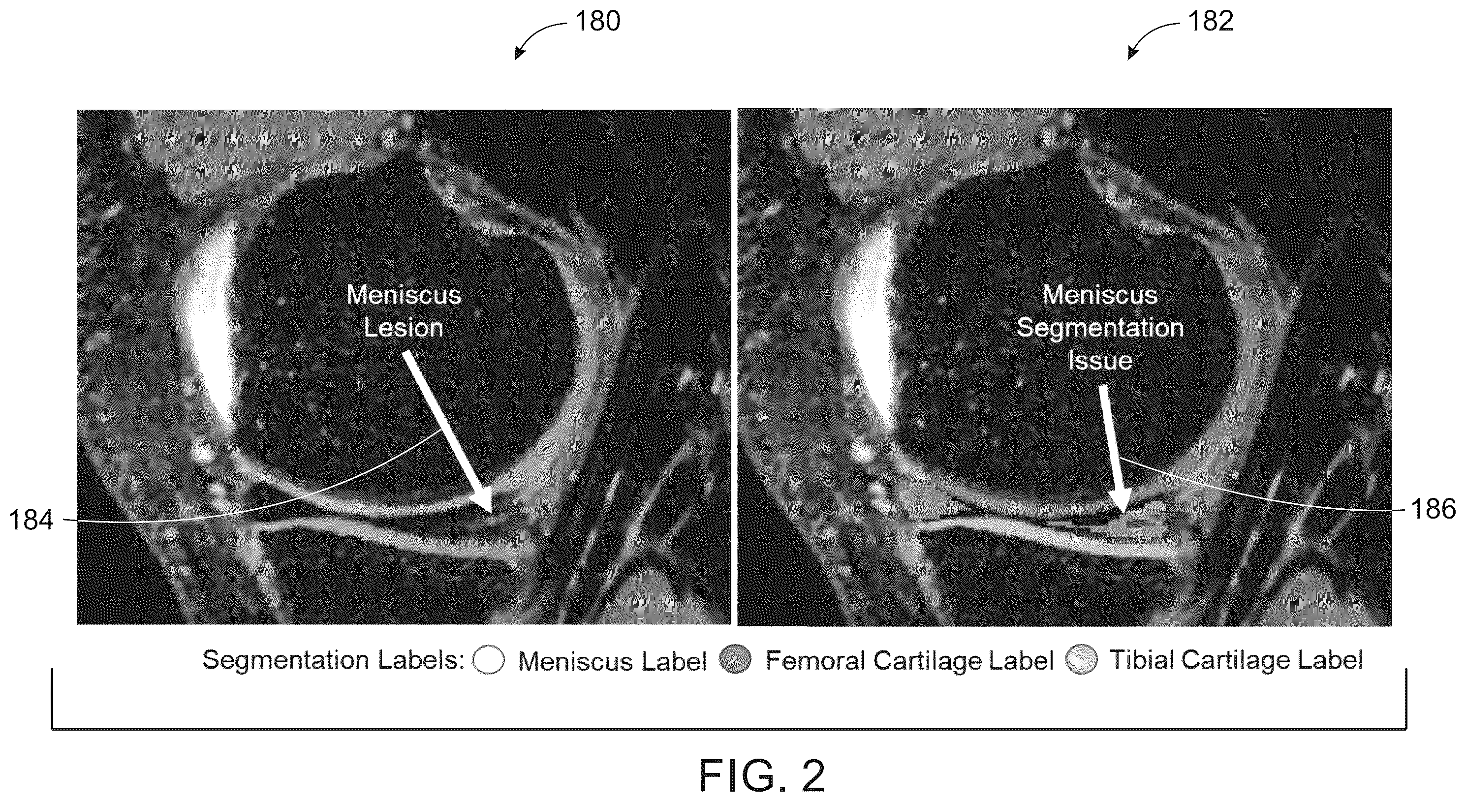 Patent US12579643 Figure 2 – System and method for anatomical features transplantation for data variety augmentation on medical images