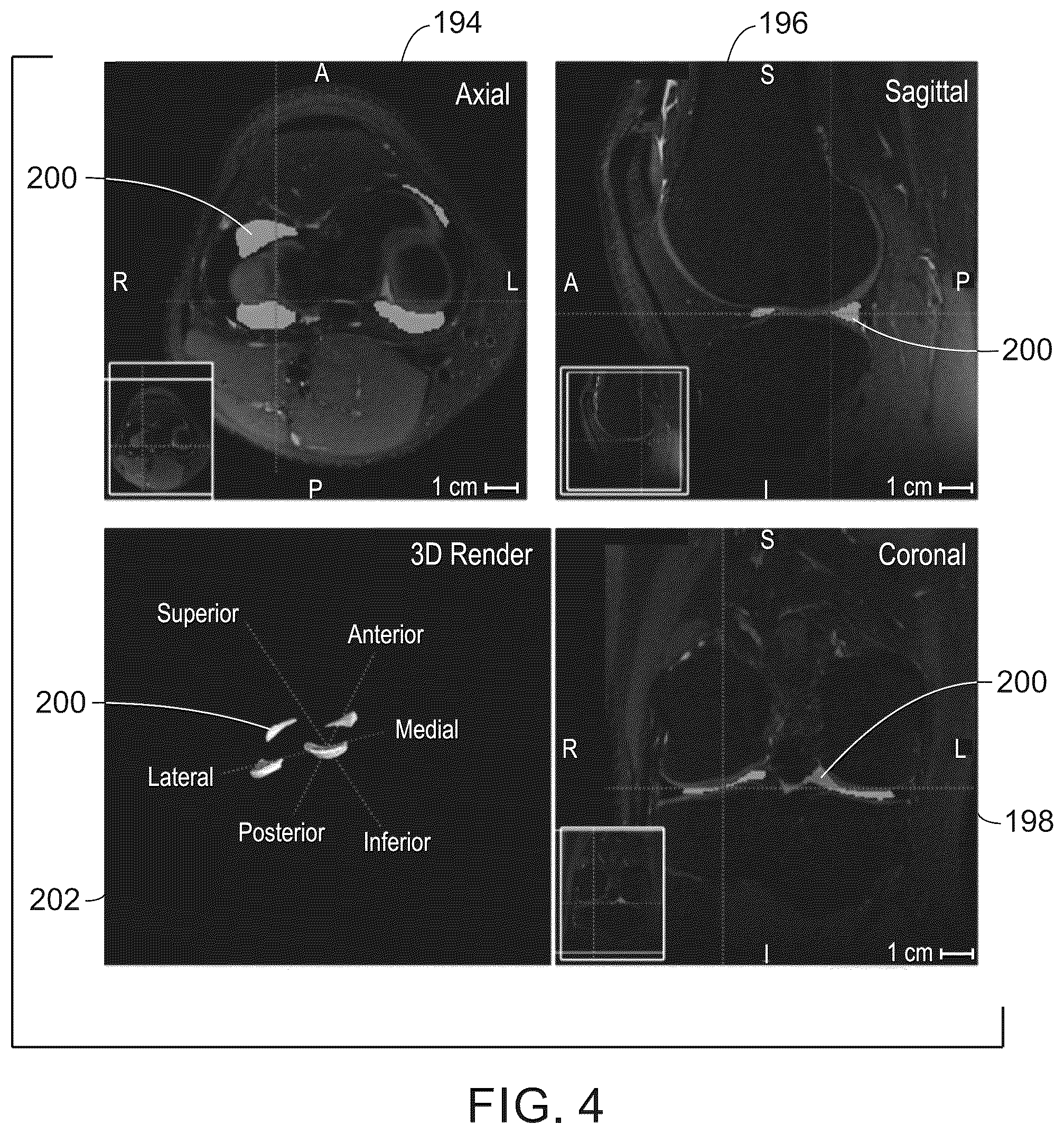Patent US12579643 Figure 4 – System and method for anatomical features transplantation for data variety augmentation on medical images