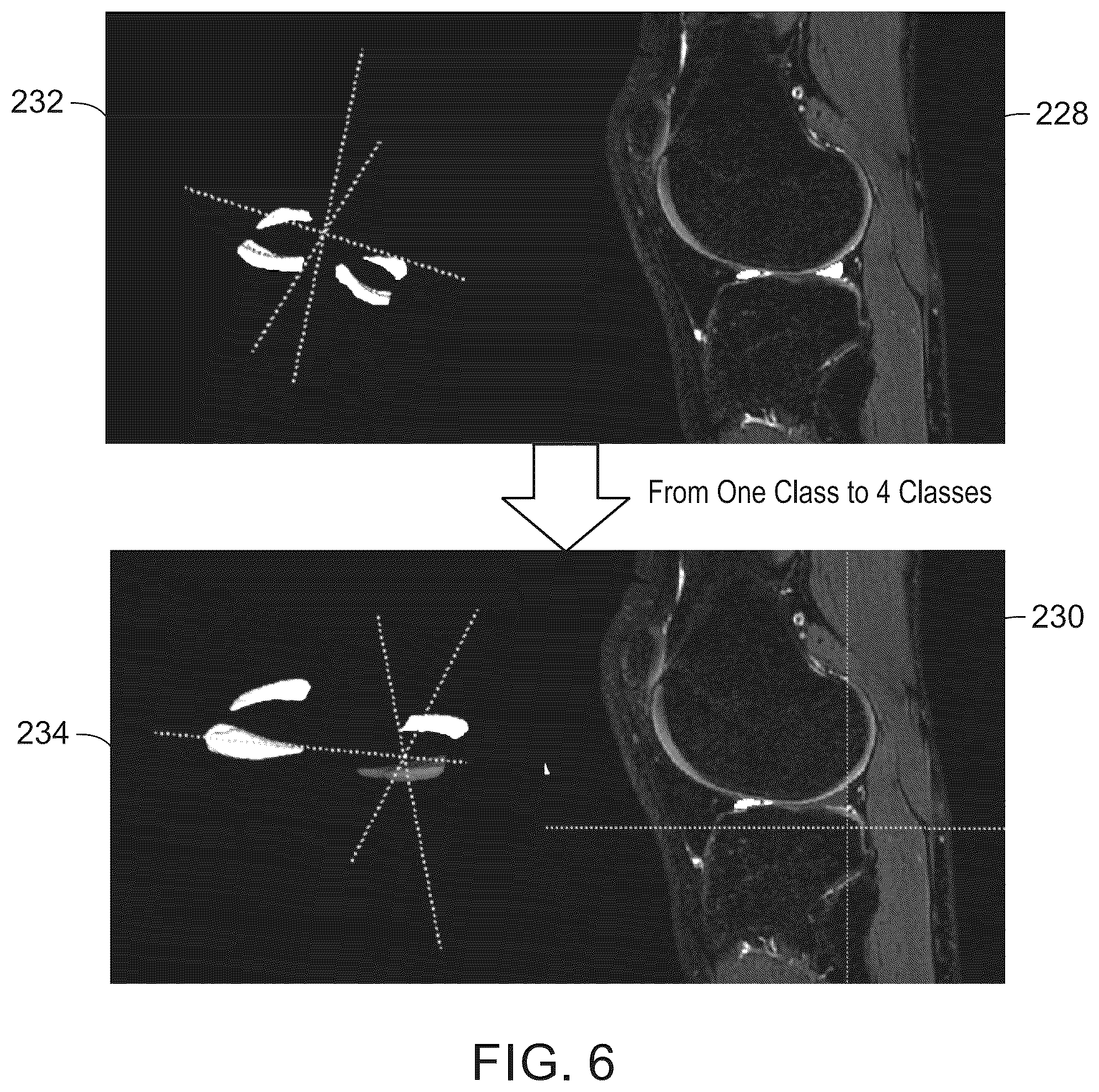 Patent US12579643 Figure 6 – System and method for anatomical features transplantation for data variety augmentation on medical images
