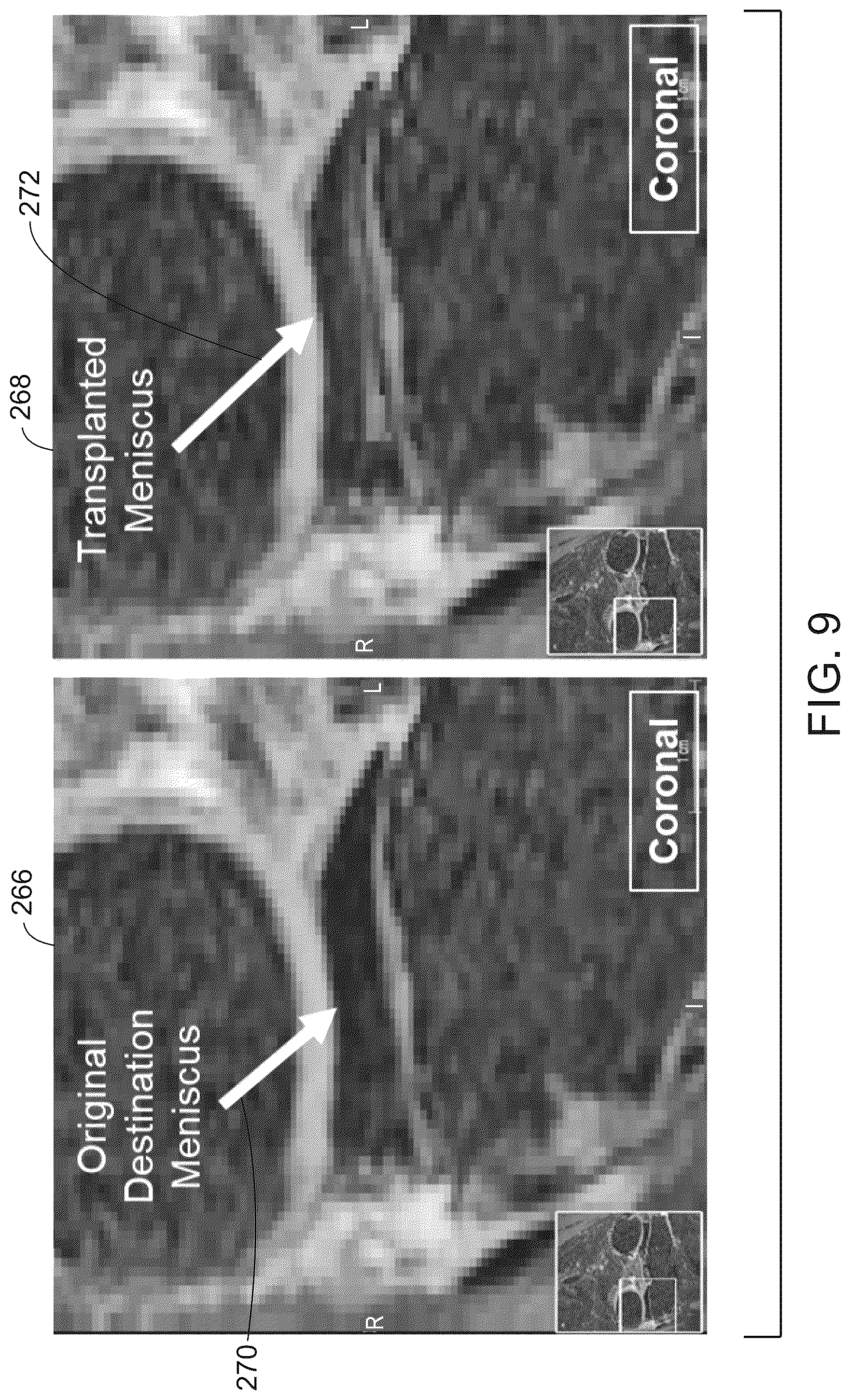 Patent US12579643 Figure 9 – System and method for anatomical features transplantation for data variety augmentation on medical images