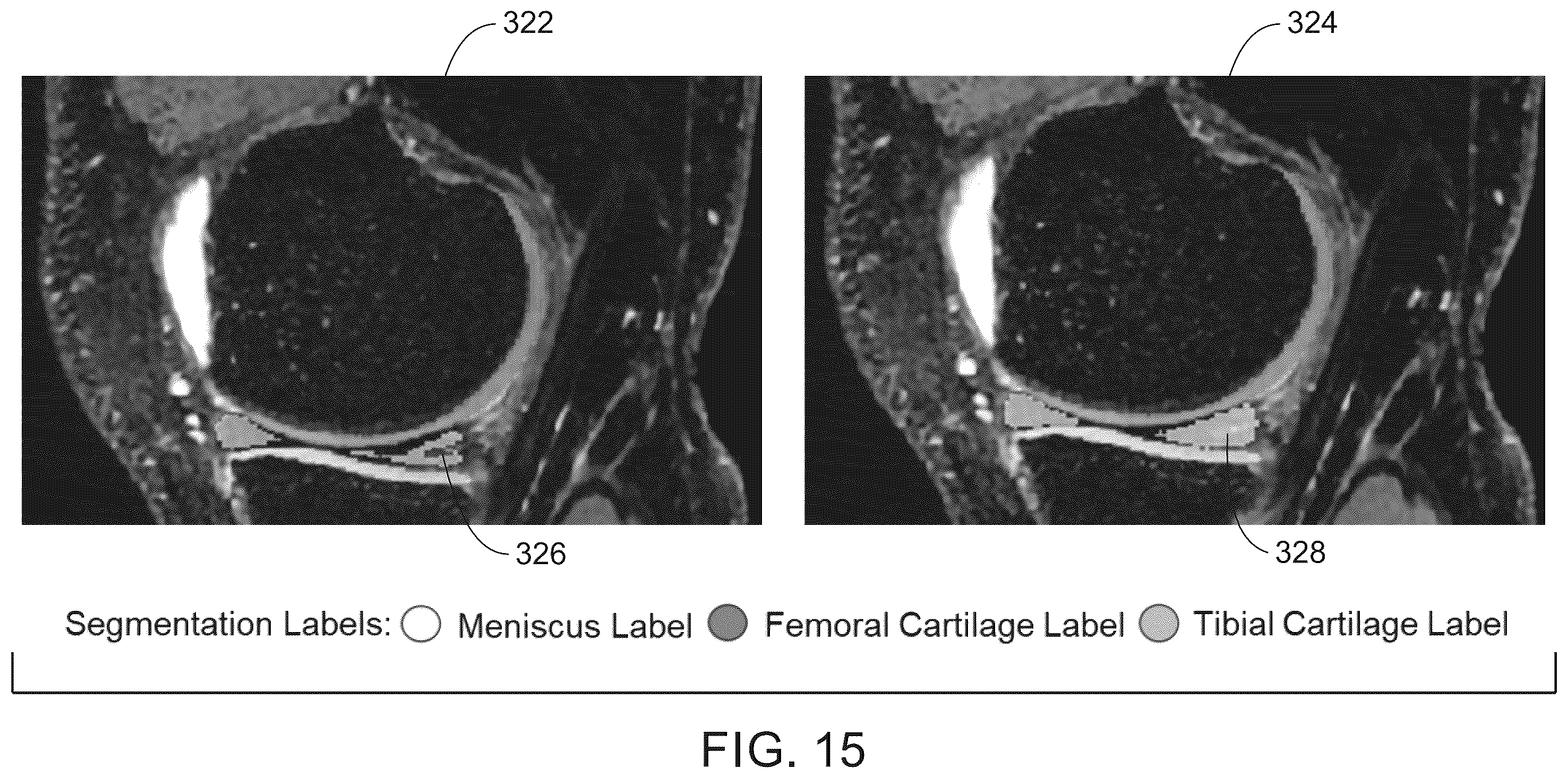 Patent US12579643 Figure 15 – System and method for anatomical features transplantation for data variety augmentation on medical images