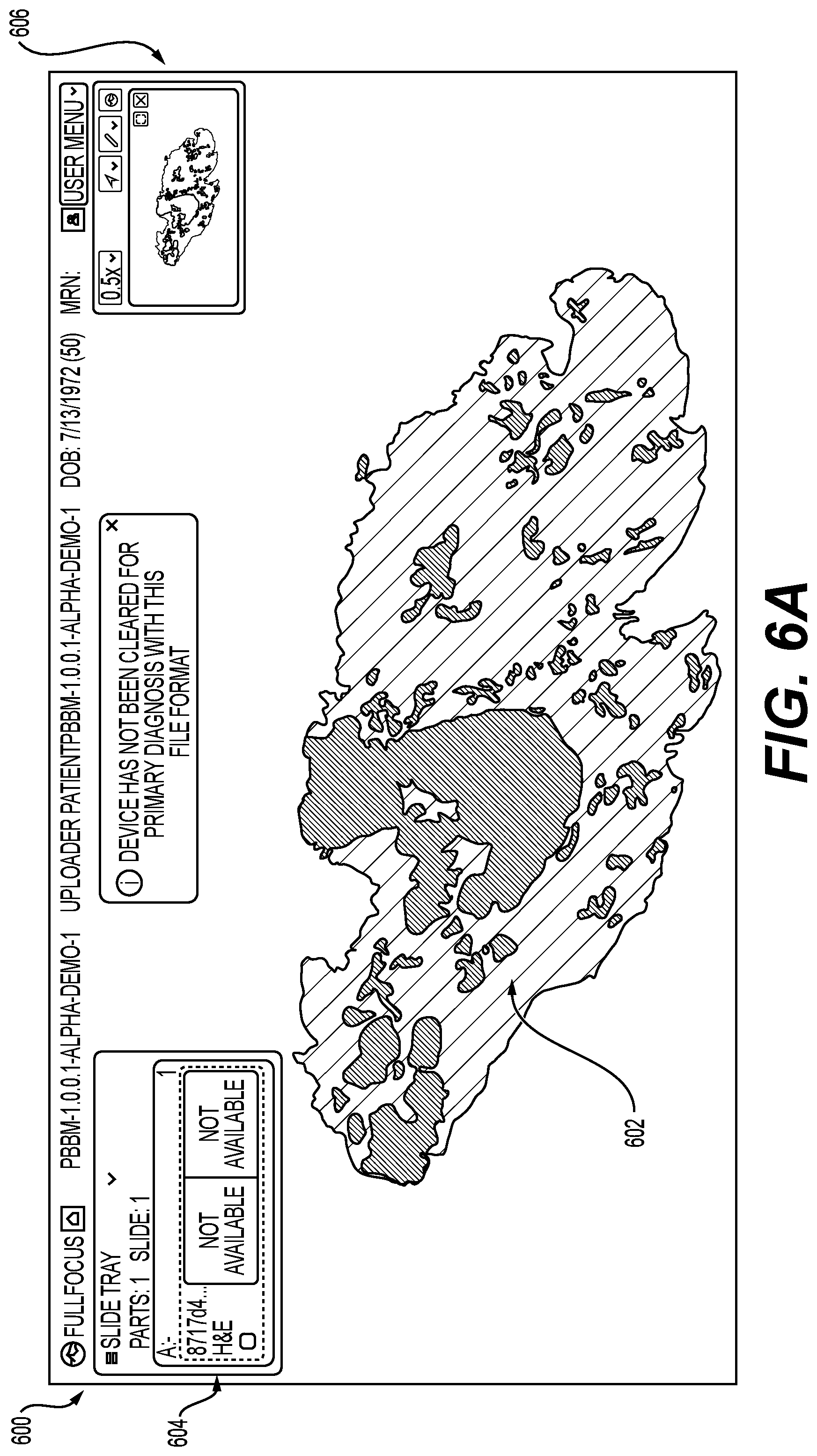 Patent US12579645 Figure 8 – Systems and methods for processing images to determine biomarker levels