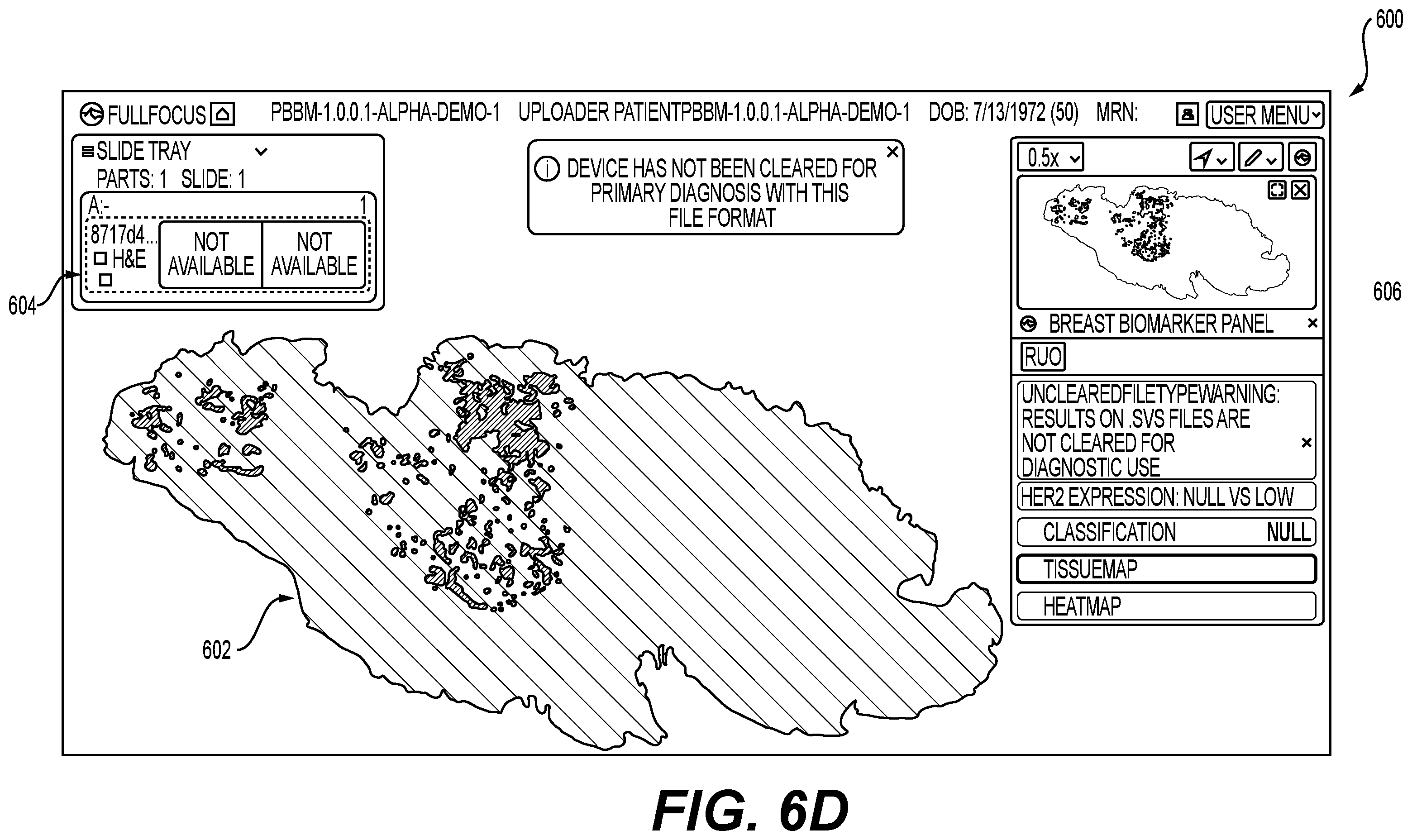 Patent US12579645 Figure 11 – Systems and methods for processing images to determine biomarker levels