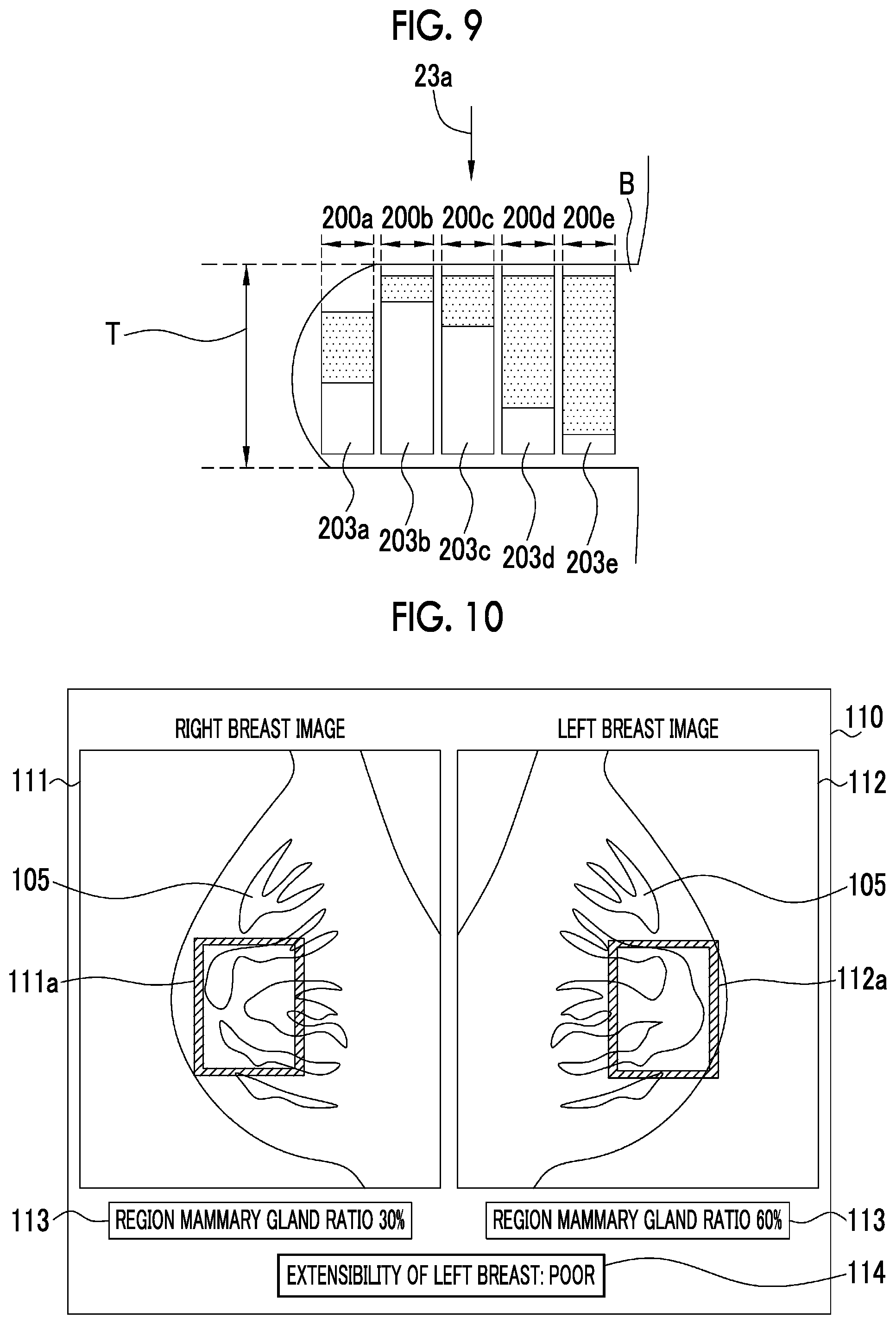 Patent US12579649 Figure 5 – Radiation image processing apparatus and operation method thereof