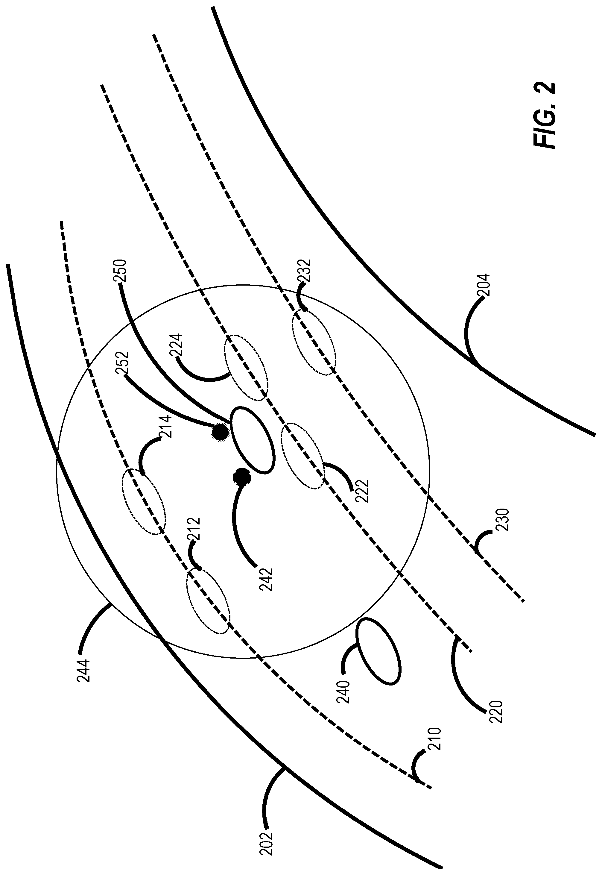 Patent US12579662 Figure 2 – High-precision localization of a moving object on a trajectory