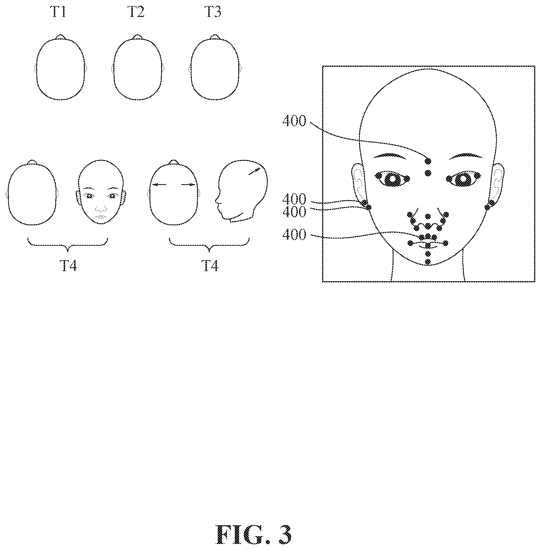 Patent US12579673 Figure 3 – Evaluation method of craniofacial asymmetry index based on artificial intelligence