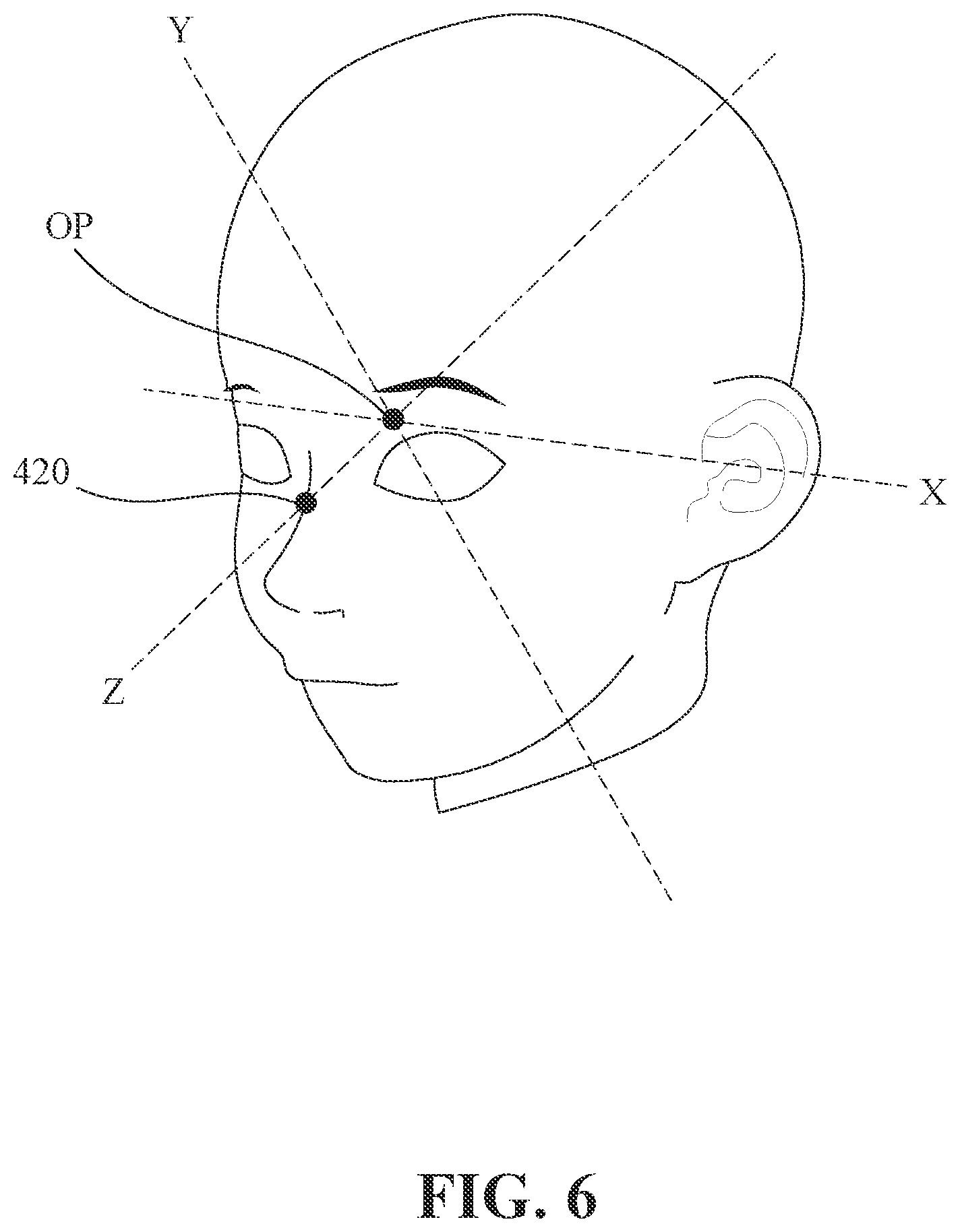 Patent US12579673 Figure 6 – Evaluation method of craniofacial asymmetry index based on artificial intelligence