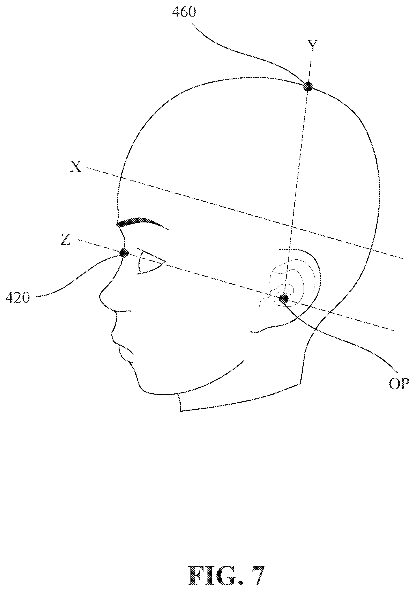 Patent US12579673 Figure 7 – Evaluation method of craniofacial asymmetry index based on artificial intelligence