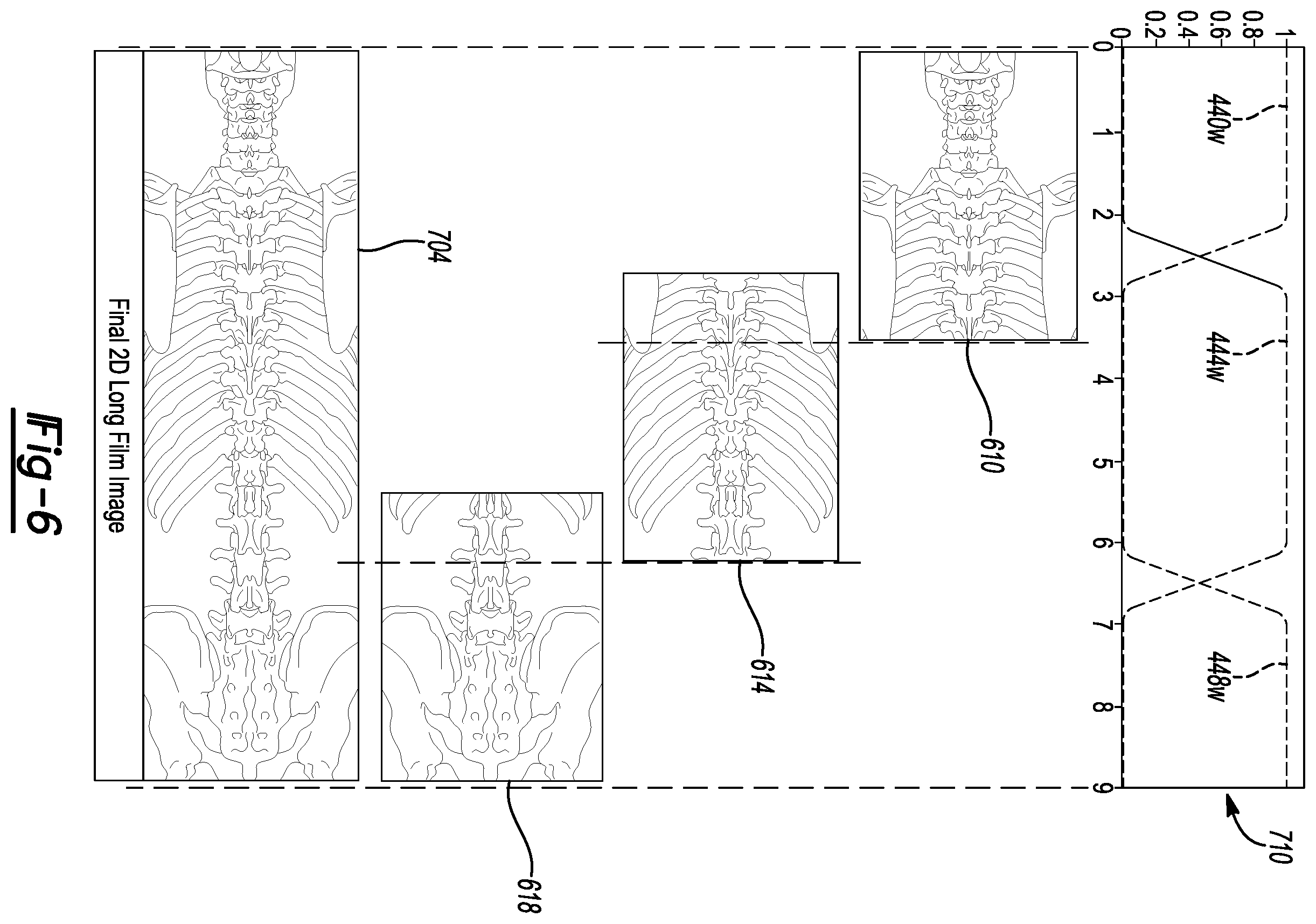 Patent US12579679 Figure 5 – System and method for identifying feature in an image of a subject
