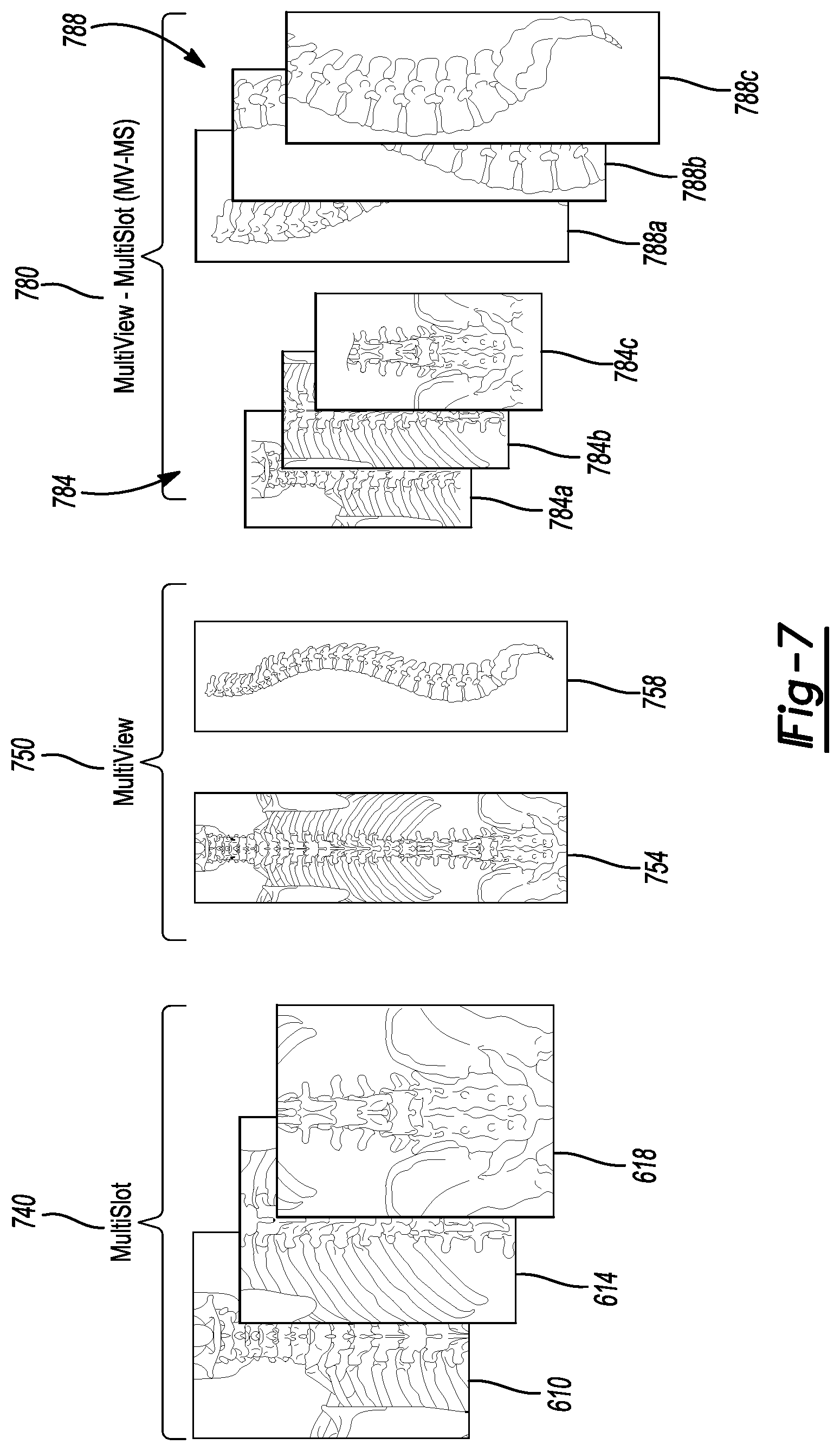 Patent US12579679 Figure 6 – System and method for identifying feature in an image of a subject
