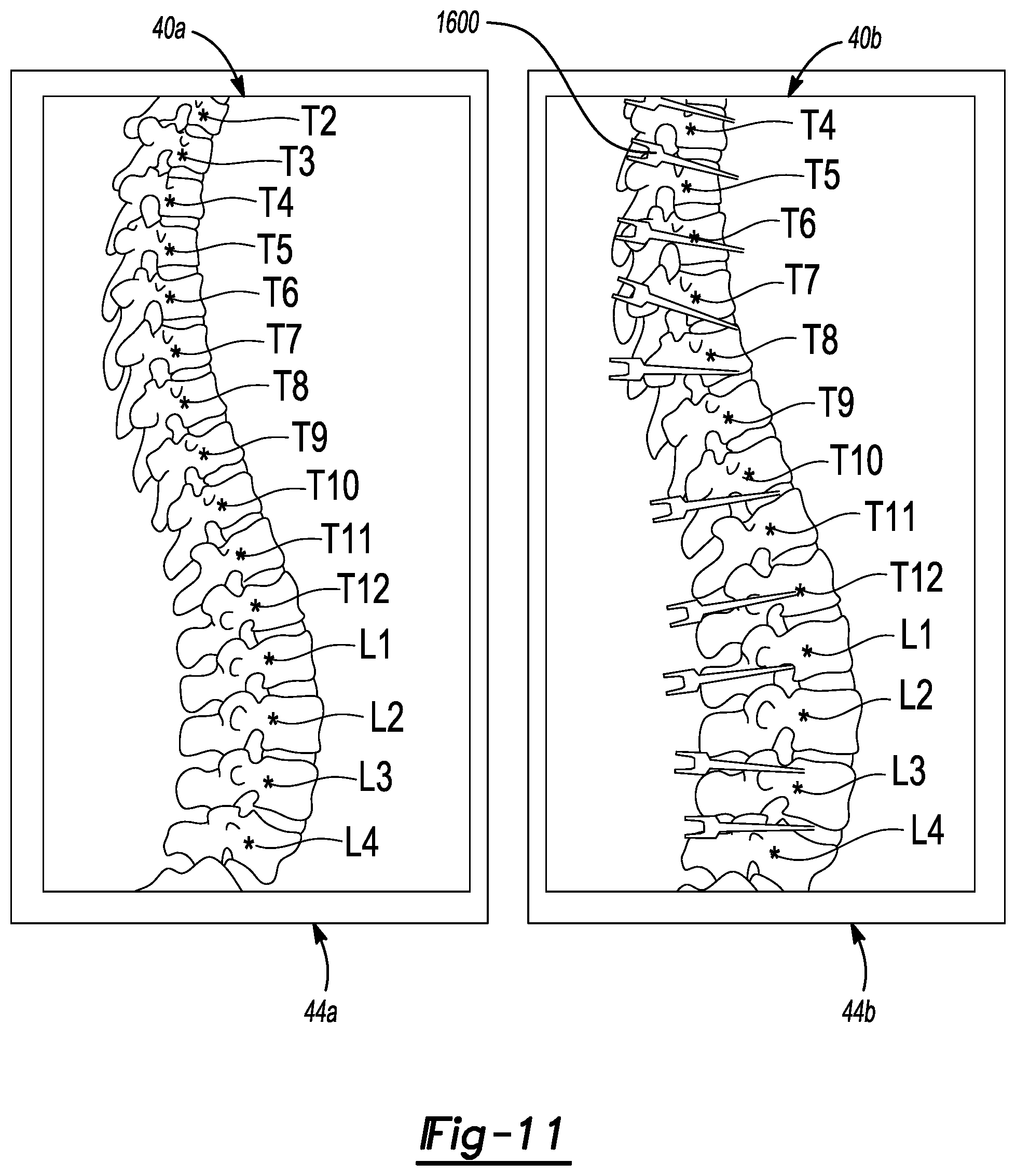 Patent US12579679 Figure 10 – System and method for identifying feature in an image of a subject