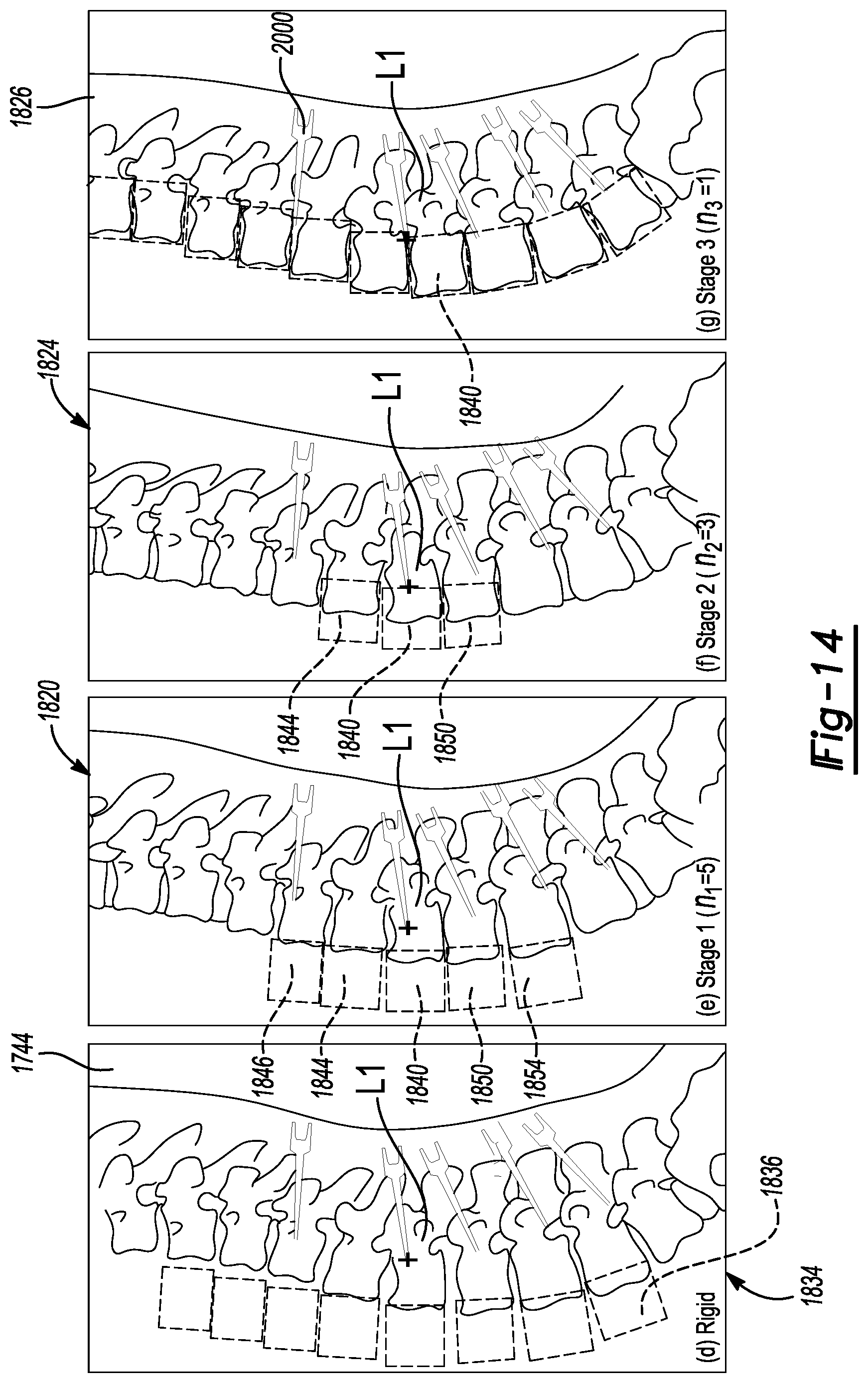 Patent US12579679 Figure 13 – System and method for identifying feature in an image of a subject
