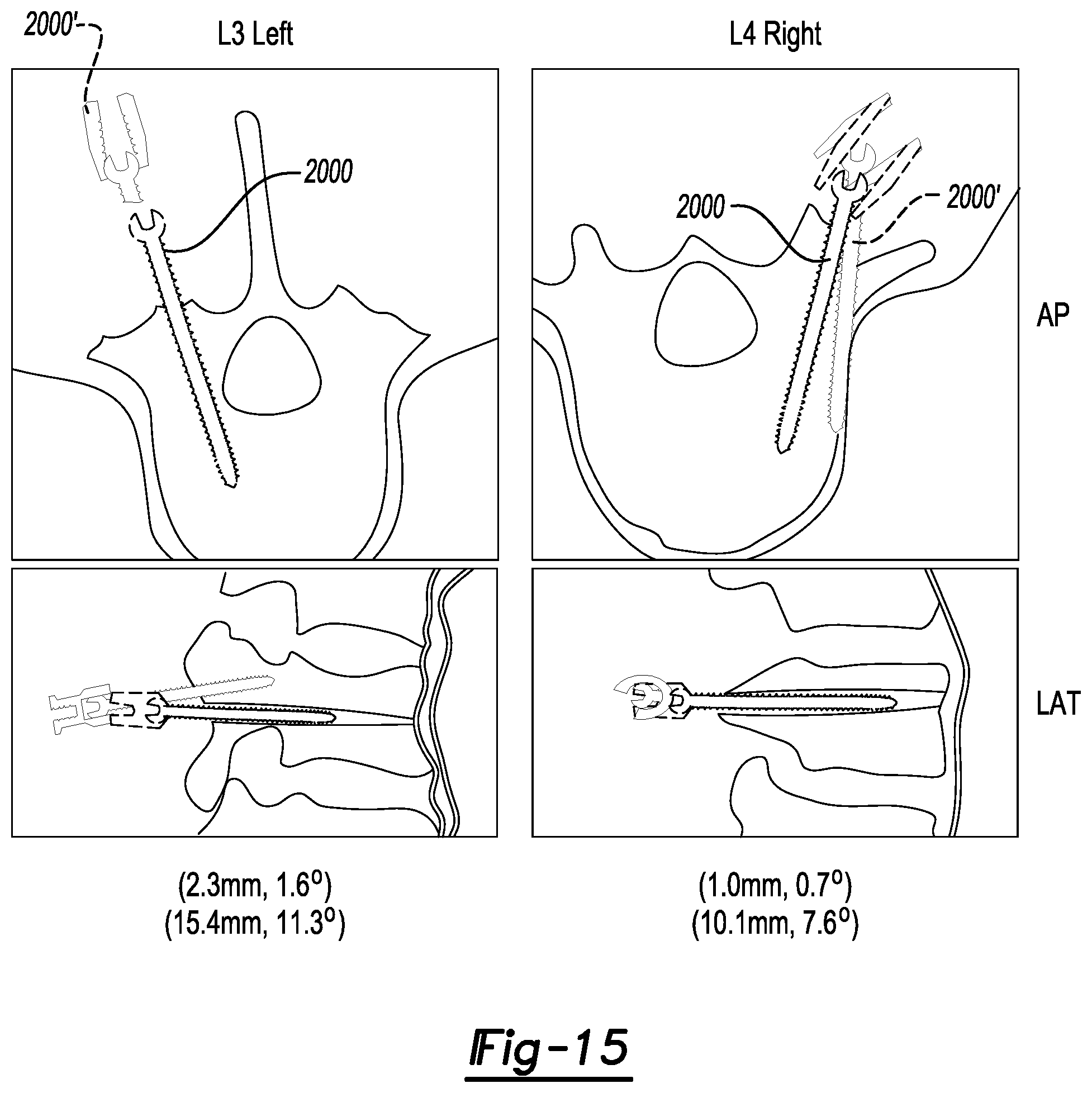 Patent US12579679 Figure 14 – System and method for identifying feature in an image of a subject