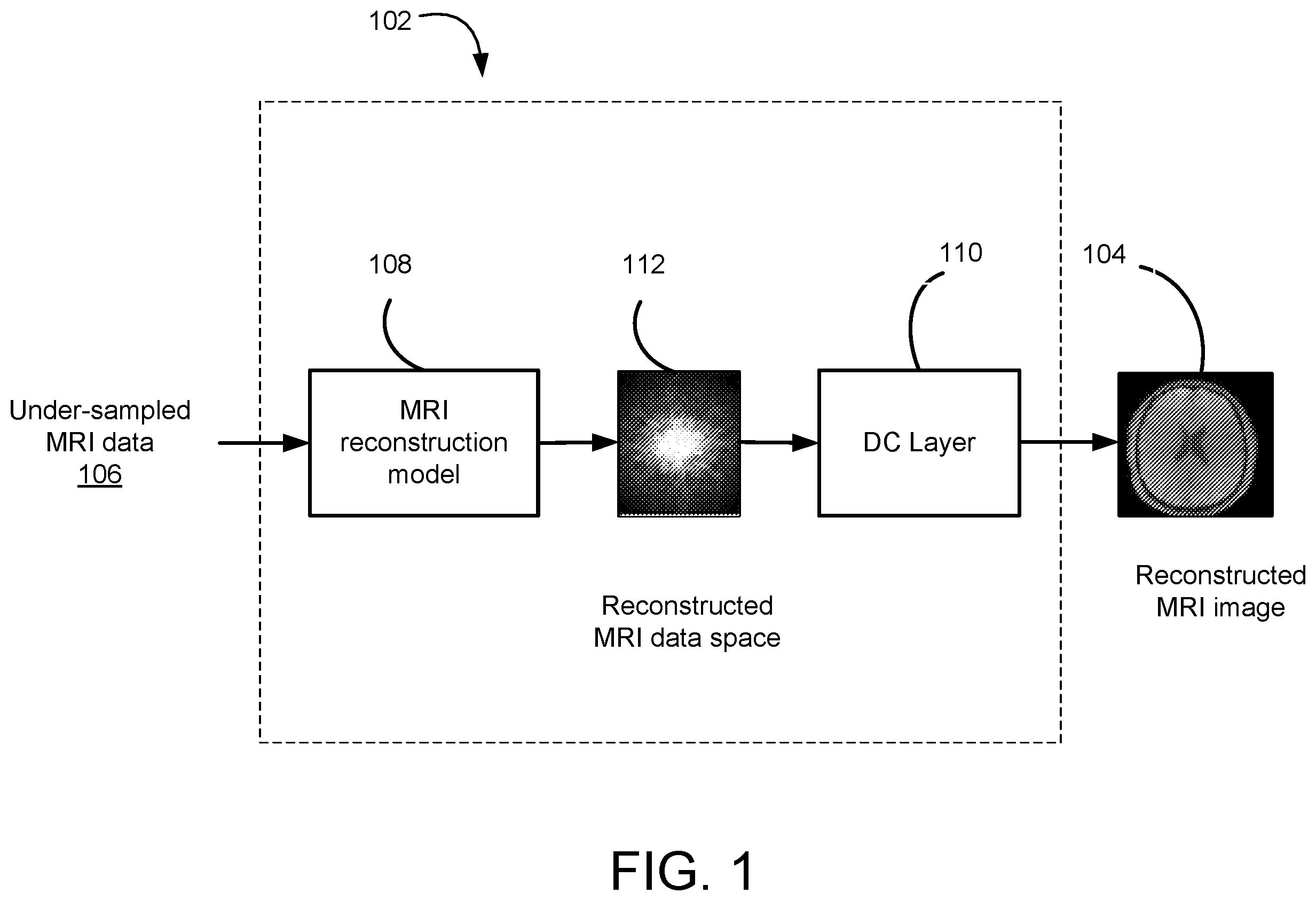 Patent US12579716 Figure 1 – MRI reconstruction based on contrastive learning