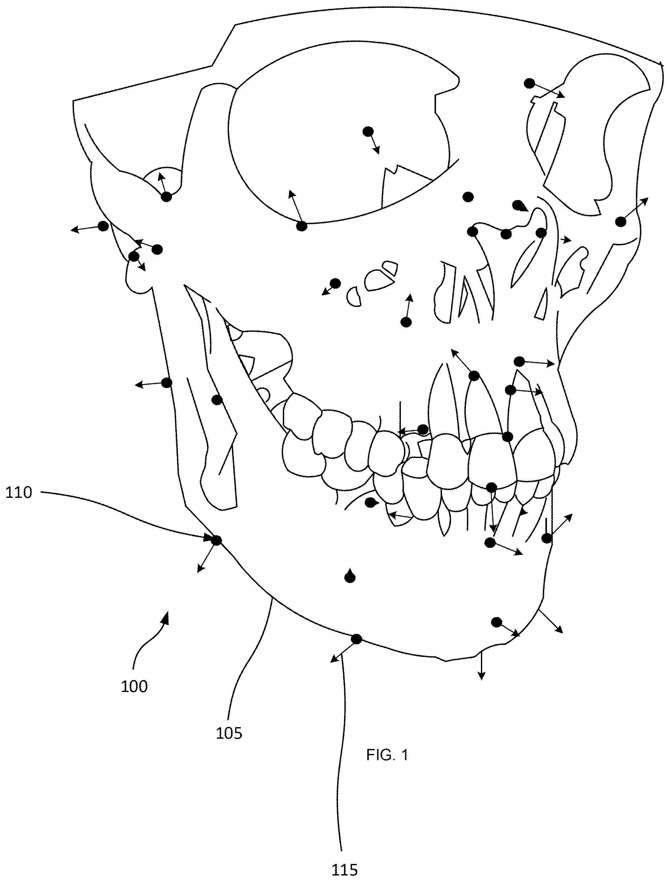 Patent US12579769 Figure 1 – Mapping and segmentation of oral maxillofacial complex and extracting clinical data