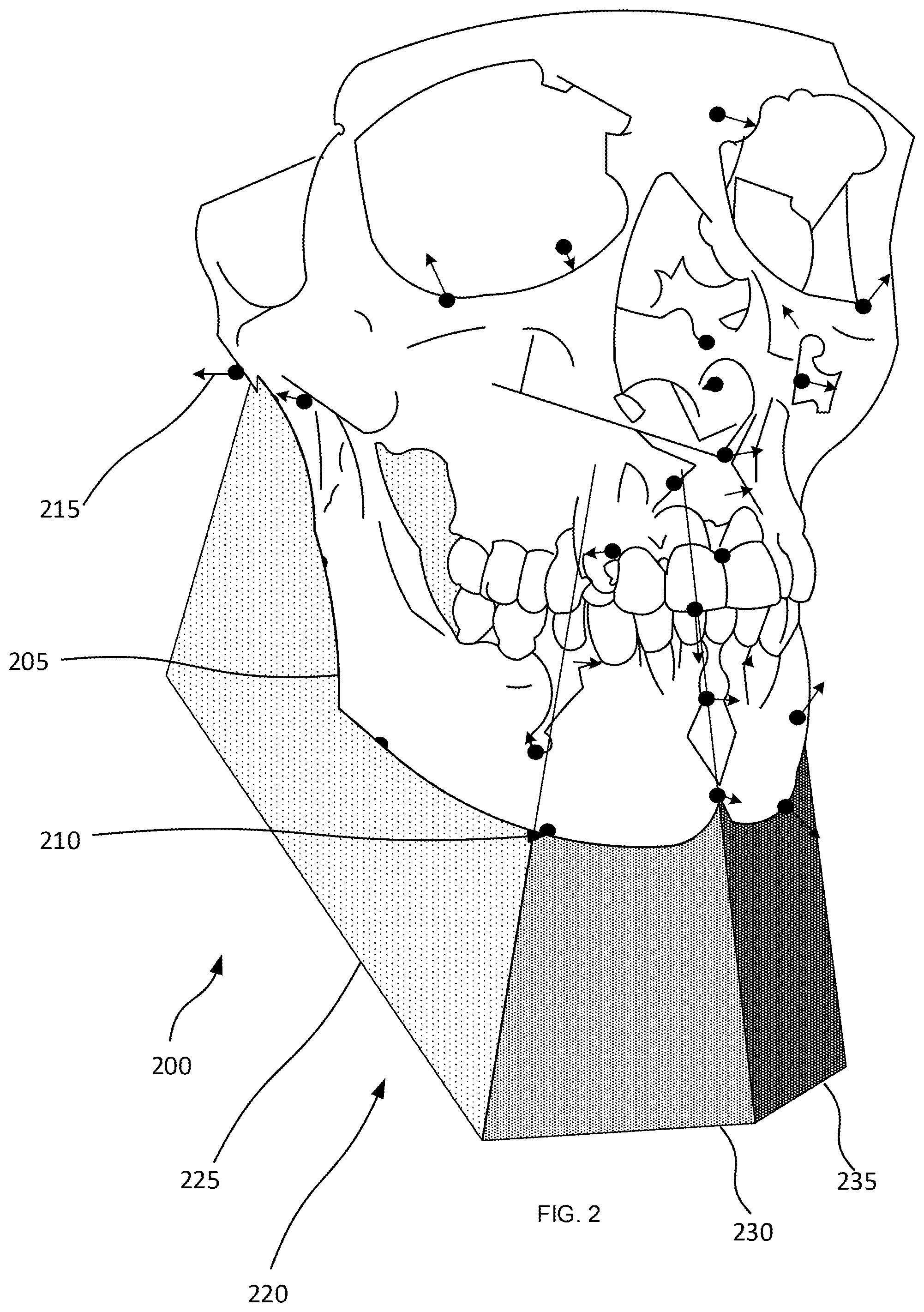 Patent US12579769 Figure 2 – Mapping and segmentation of oral maxillofacial complex and extracting clinical data