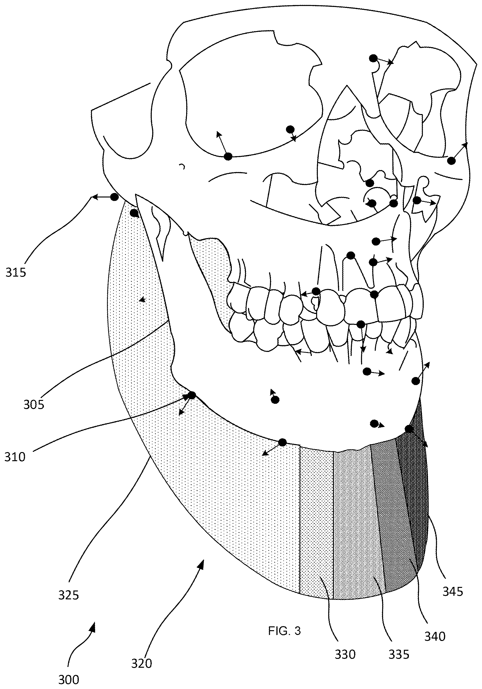 Patent US12579769 Figure 3 – Mapping and segmentation of oral maxillofacial complex and extracting clinical data