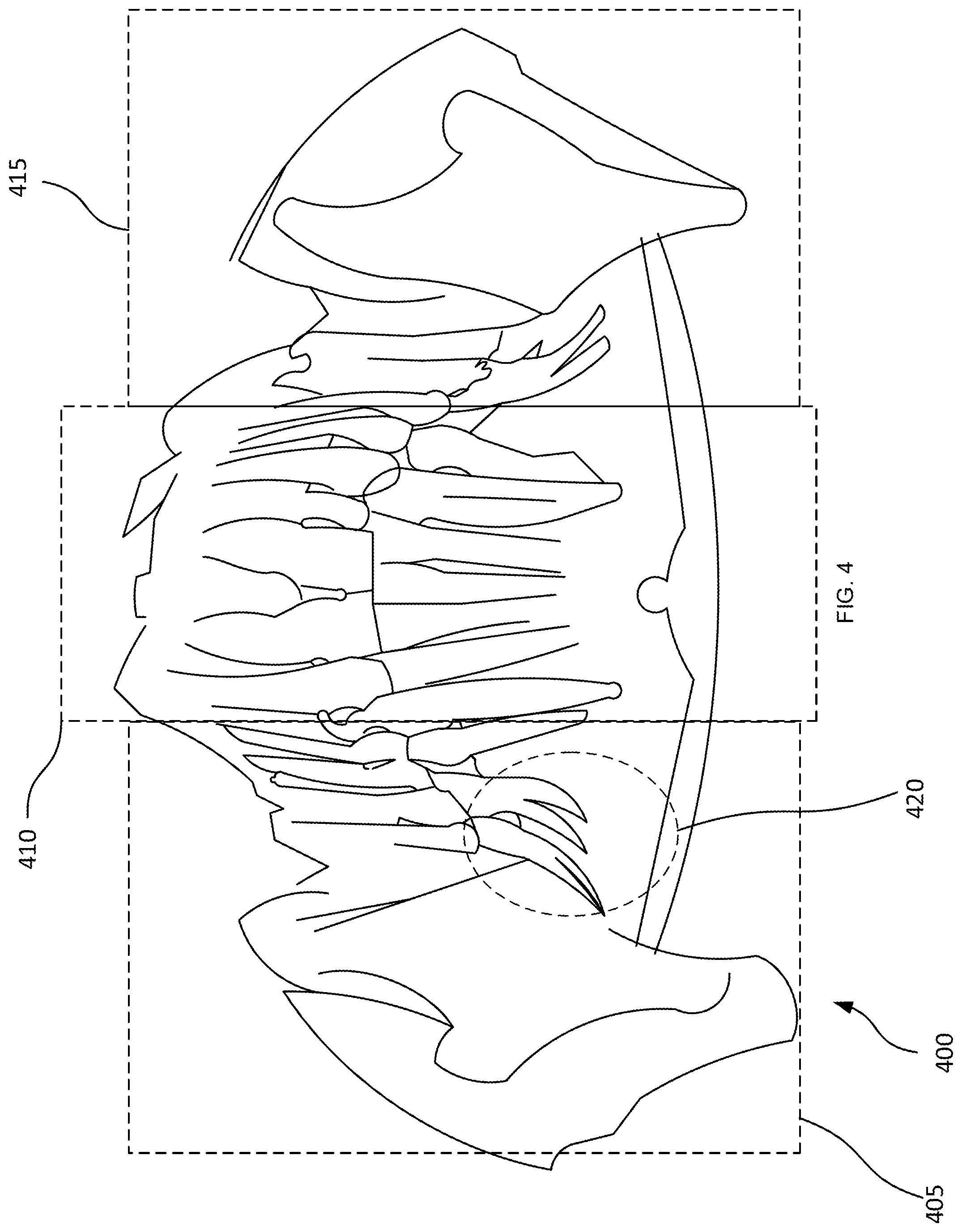 Patent US12579769 Figure 4 – Mapping and segmentation of oral maxillofacial complex and extracting clinical data