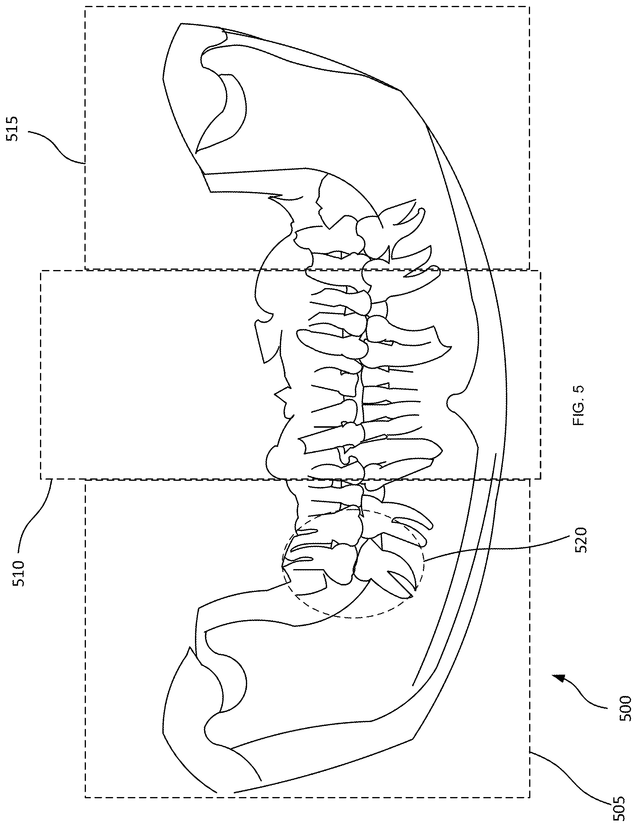 Patent US12579769 Figure 5 – Mapping and segmentation of oral maxillofacial complex and extracting clinical data