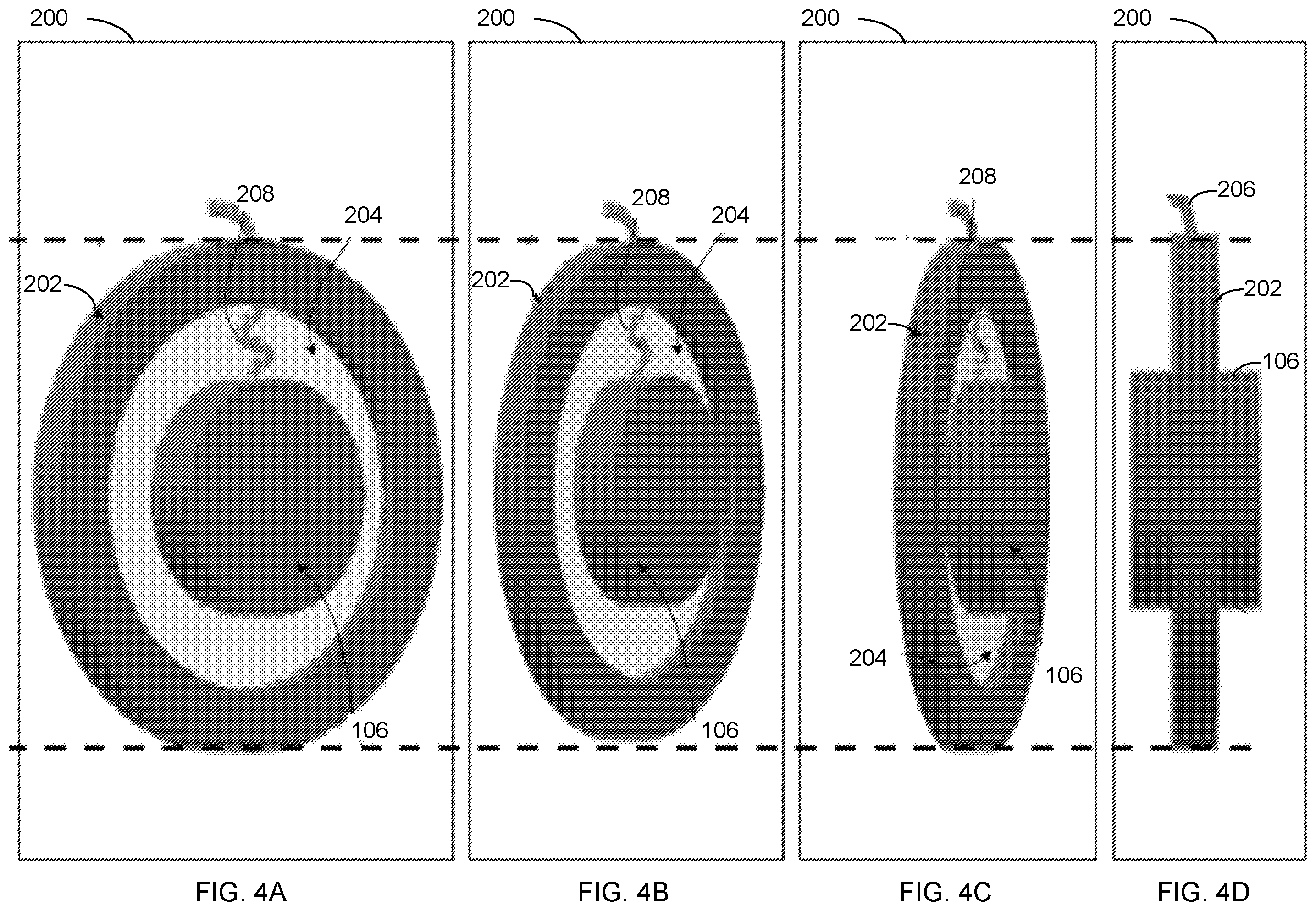 Patent US12581237 Figure 5 – Techniques for using elastic sheets to improve listening experiences associated with headphones