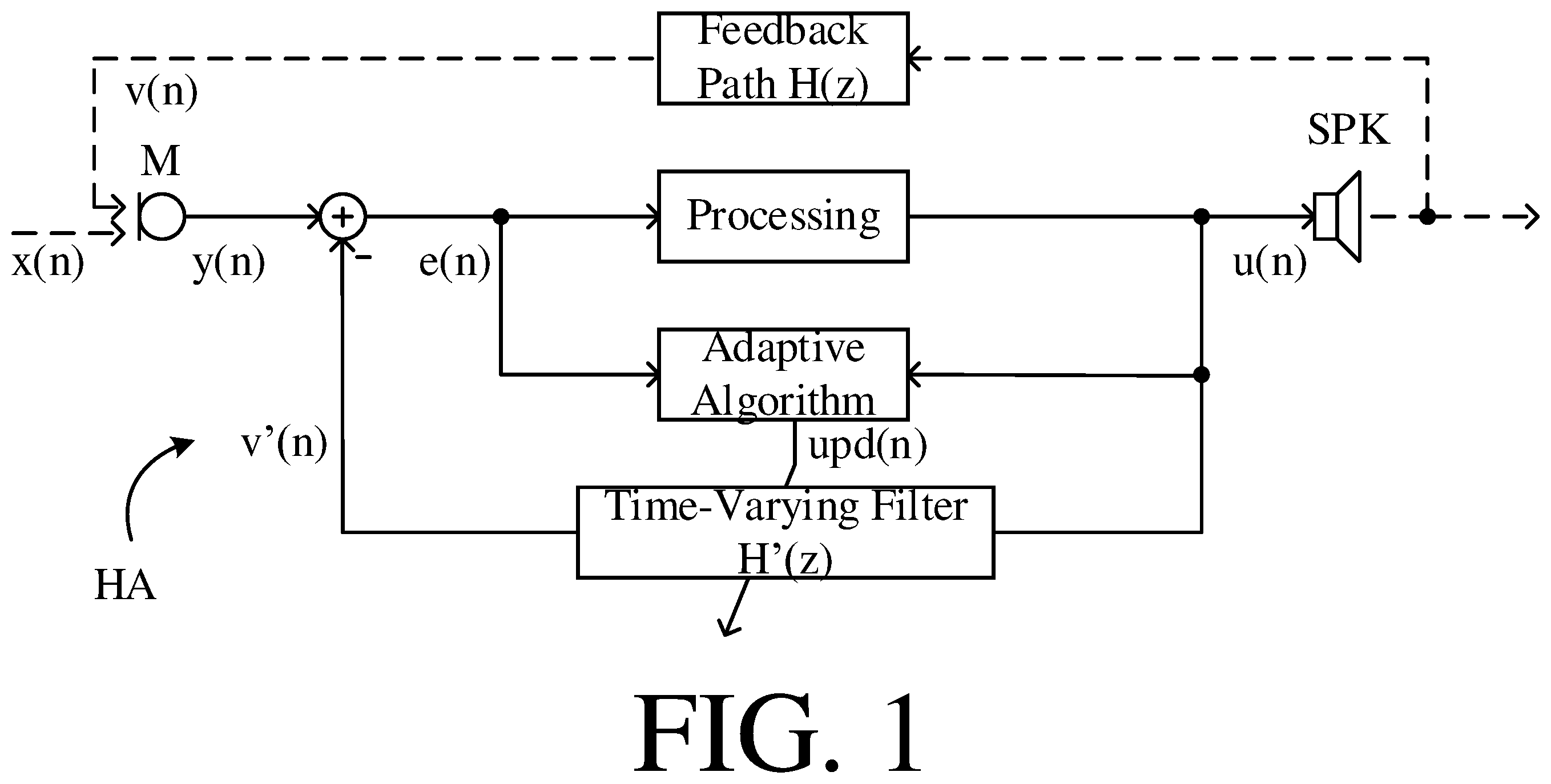 Patent US12581248 Figure 1 – Hearing aid comprising a combined feedback and active noise cancellation system
