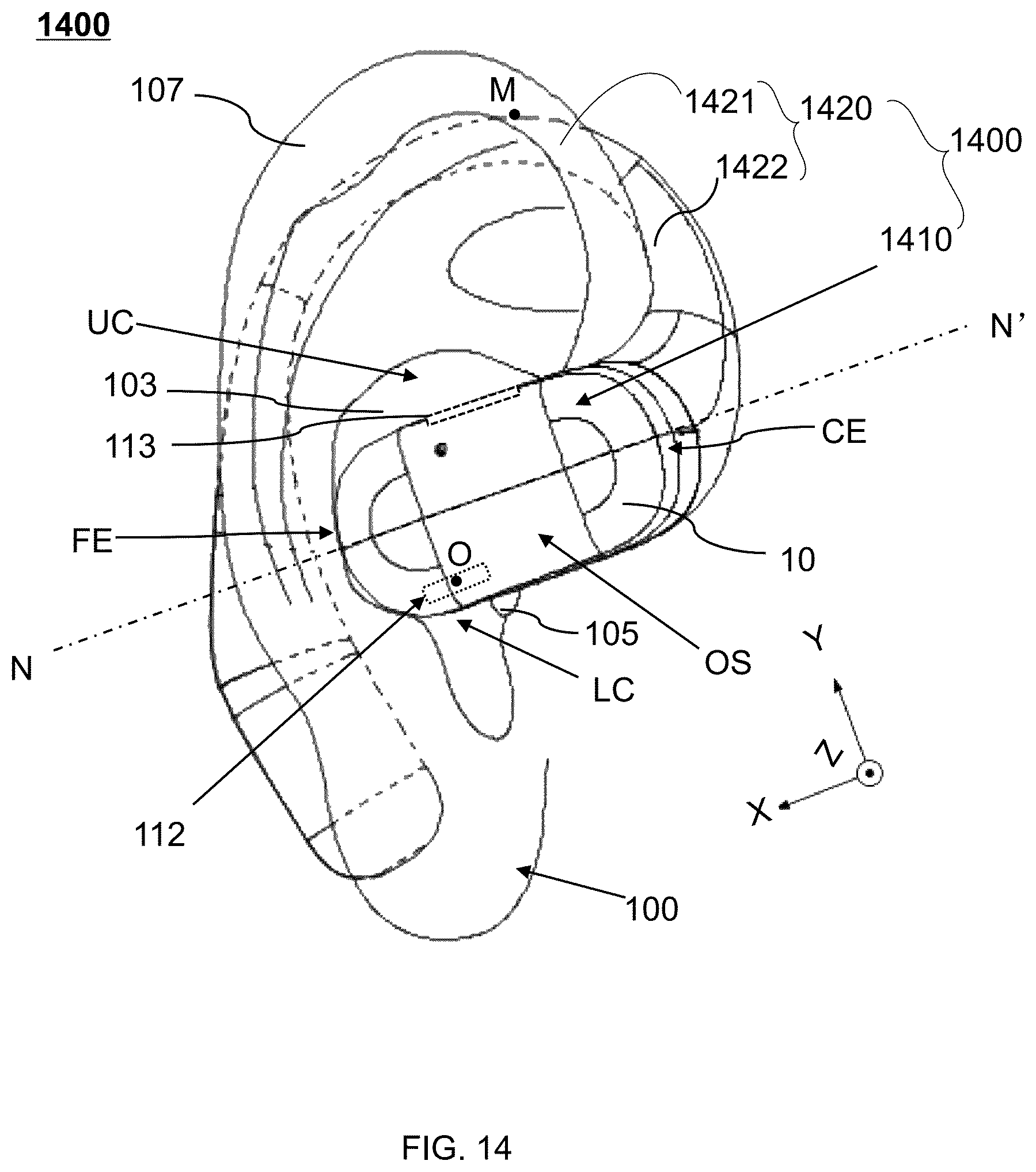 Patent US12581249 Figure 18 – Systems and methods for suppressing sound leakage