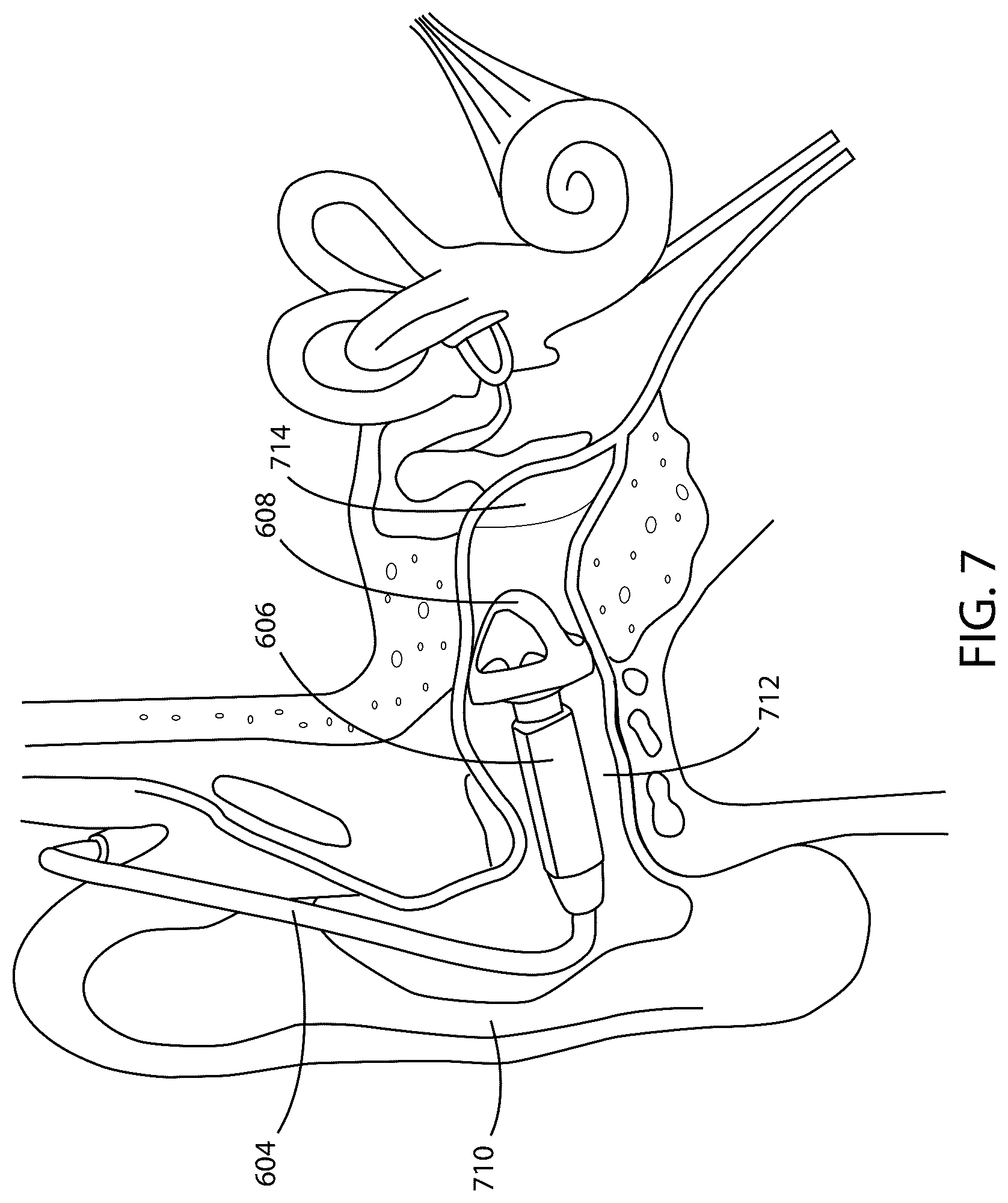 Patent US12581253 Figure 7 – Hearing assistance devices with control of other devices