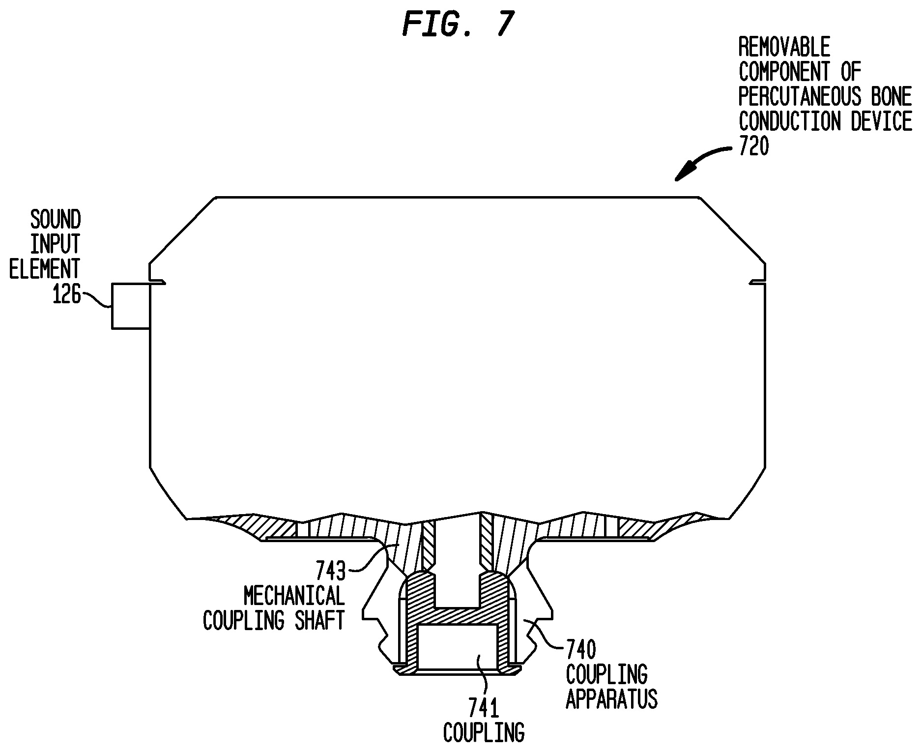 Patent US12581254 Figure 8 – Convertibility of a bone conduction device