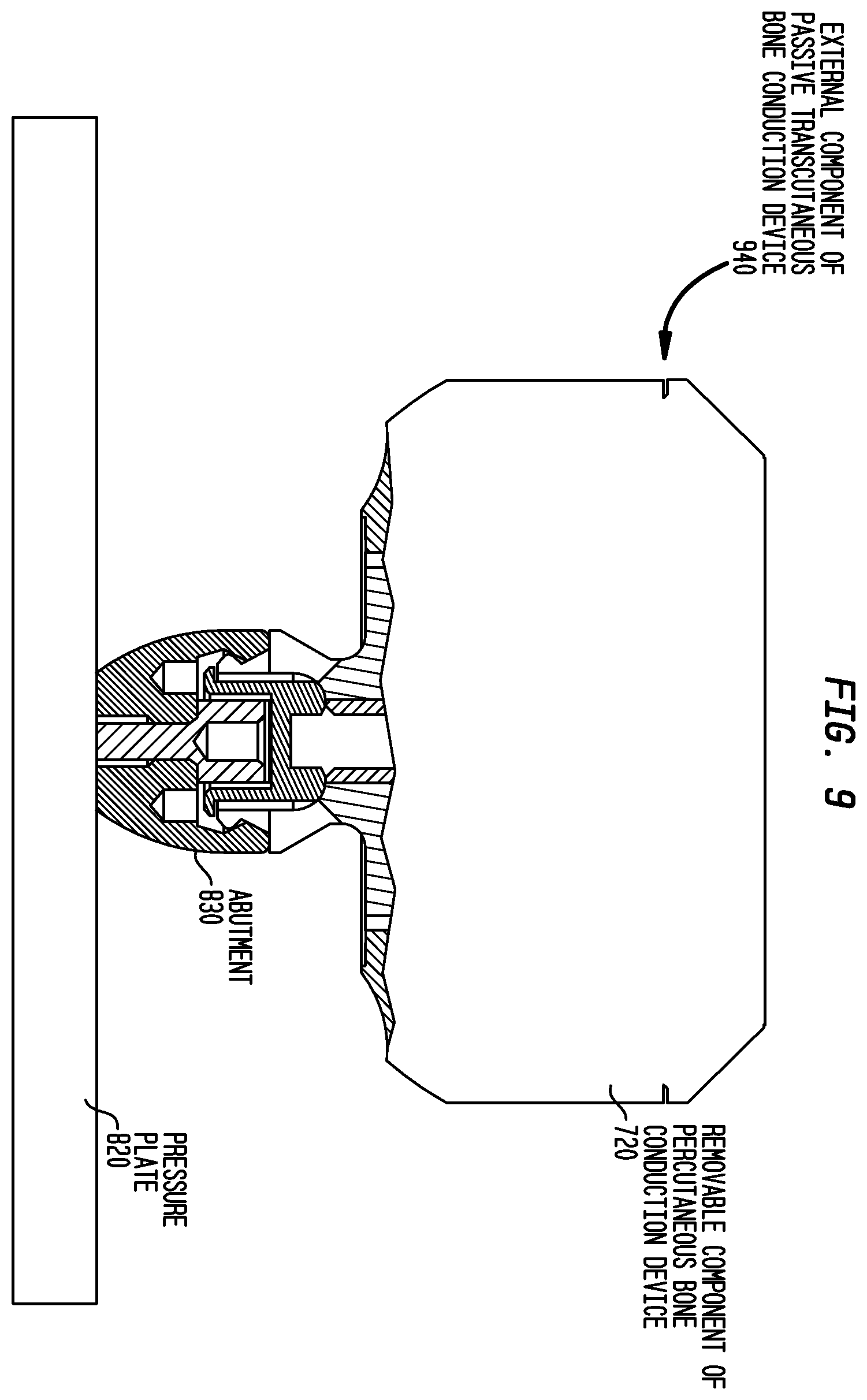 Patent US12581254 Figure 10 – Convertibility of a bone conduction device