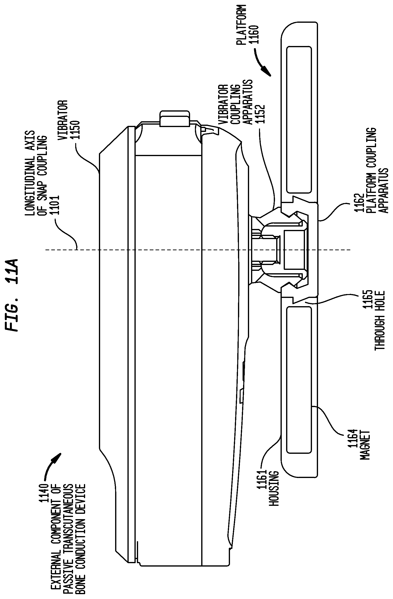 Patent US12581254 Figure 12 – Convertibility of a bone conduction device