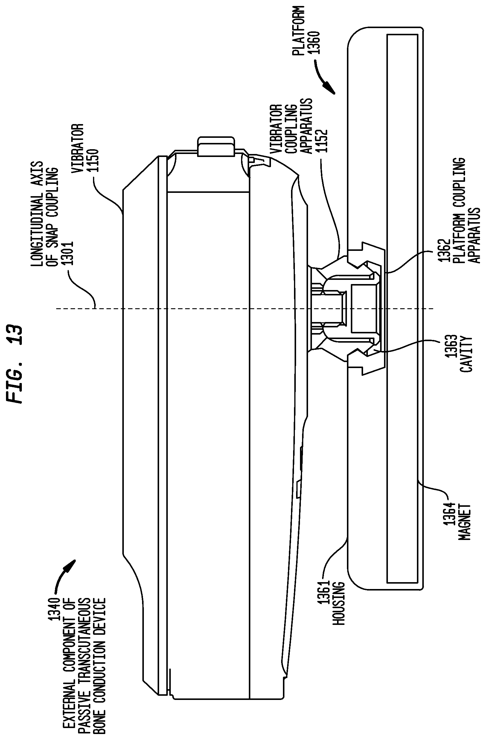 Patent US12581254 Figure 16 – Convertibility of a bone conduction device
