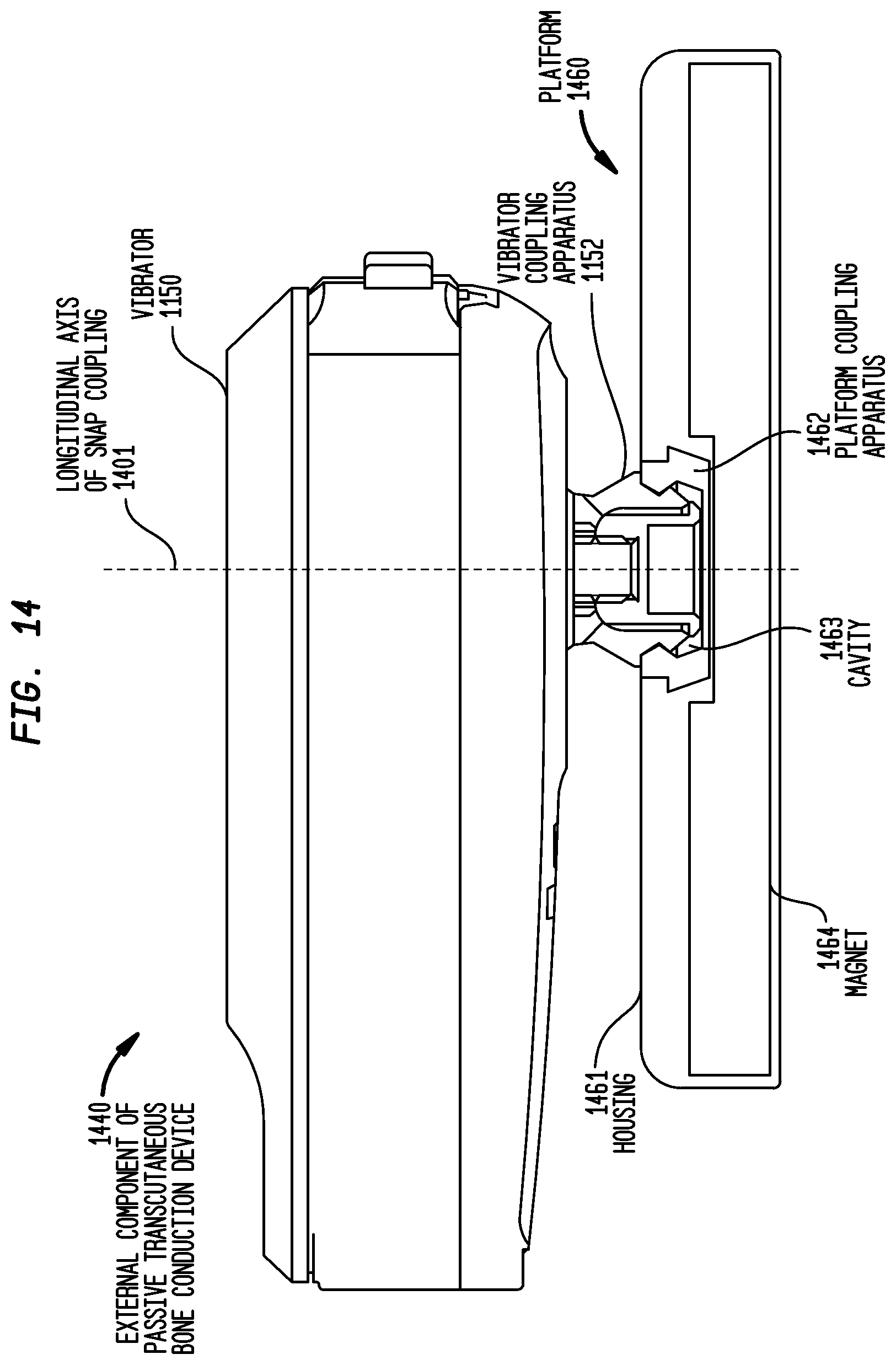 Patent US12581254 Figure 17 – Convertibility of a bone conduction device