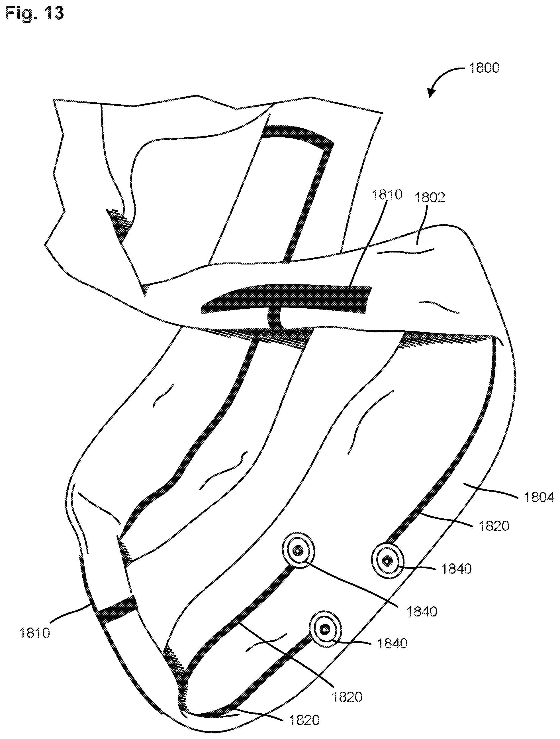 Patent US12581595 Figure 20 – Textile blank with seamless knitted electrode system