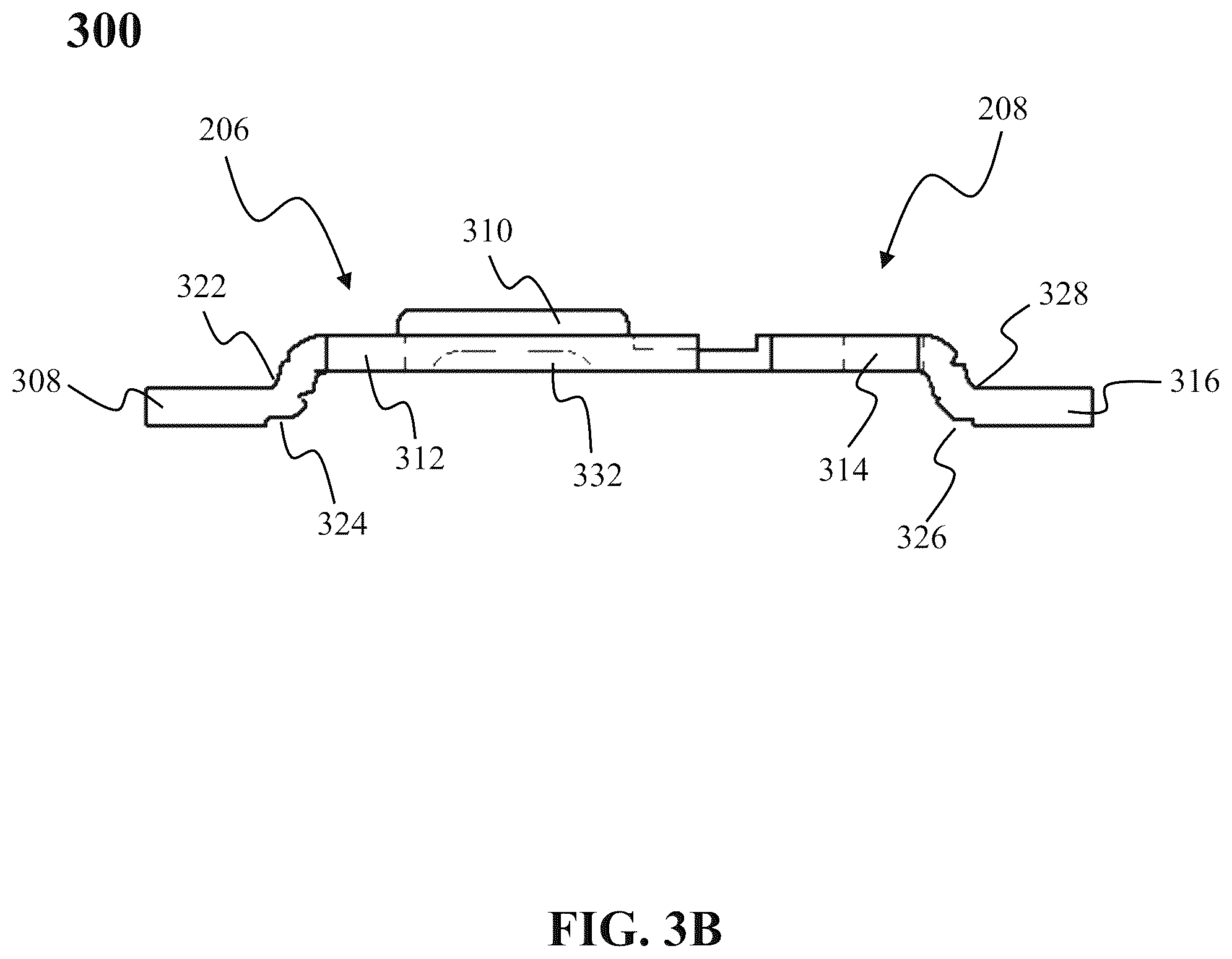 Patent US12581963 Figure 4 – Small outline TVS package compromising lead clip coin structure to support a semiconductor device