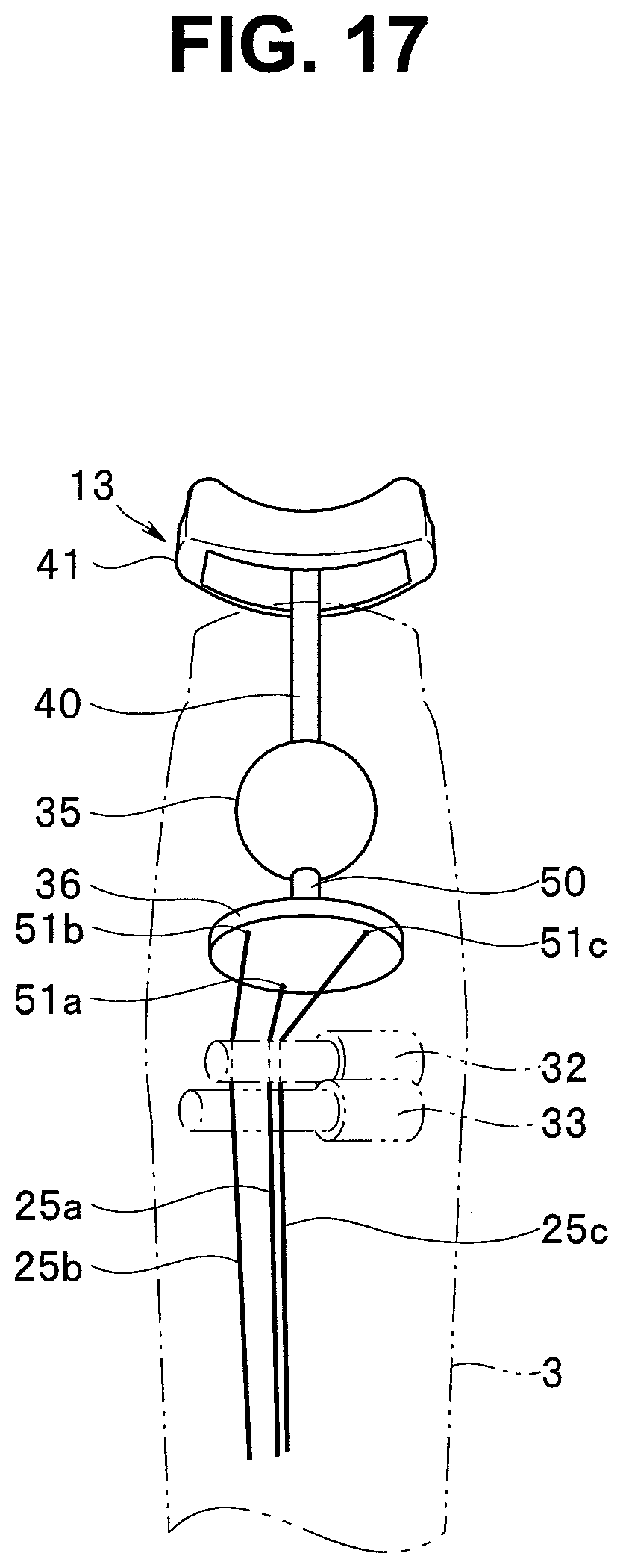 Patent US12583097 Figure 17 – Insertion instrument