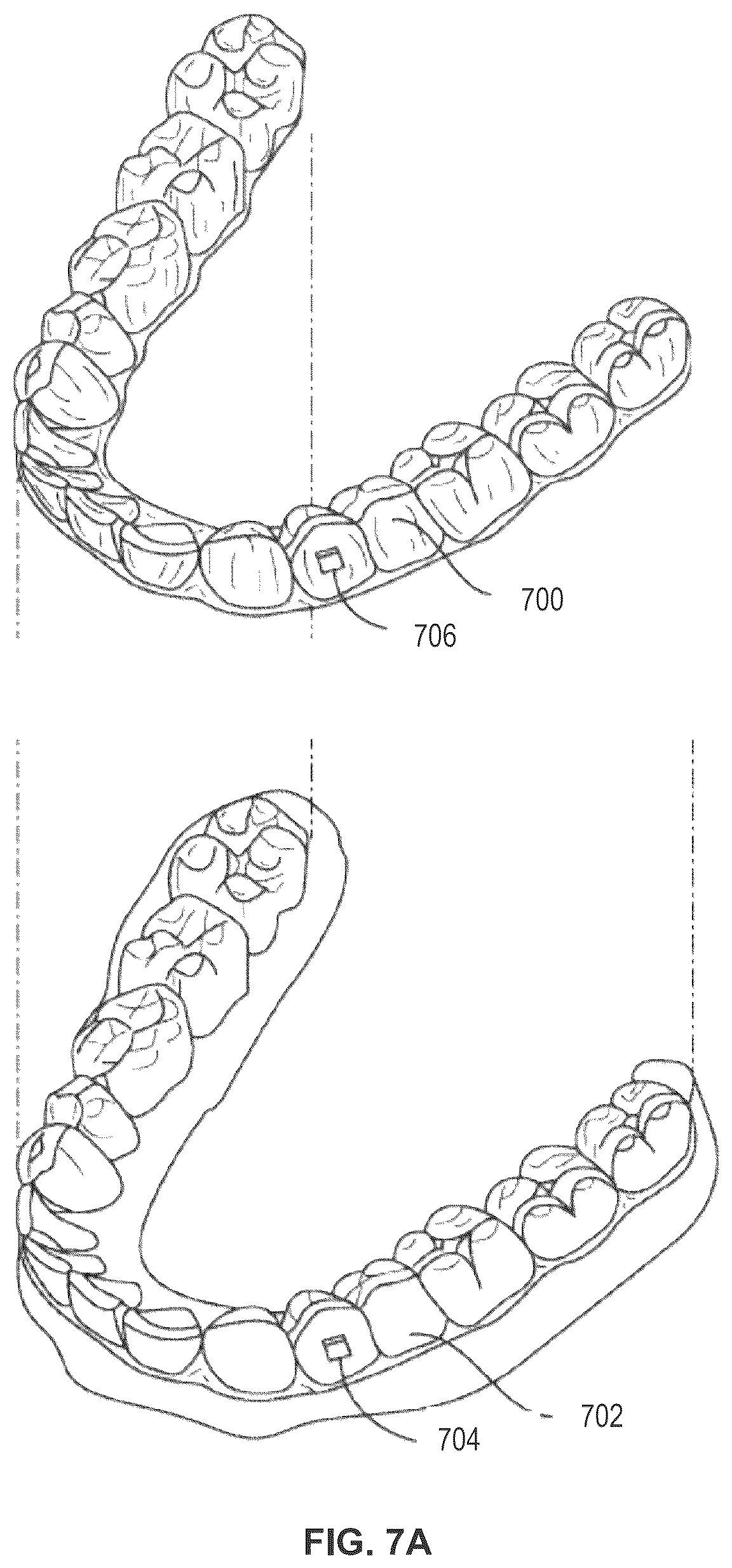 Patent US12583170 Figure 15 – Aligner manufacturing methods