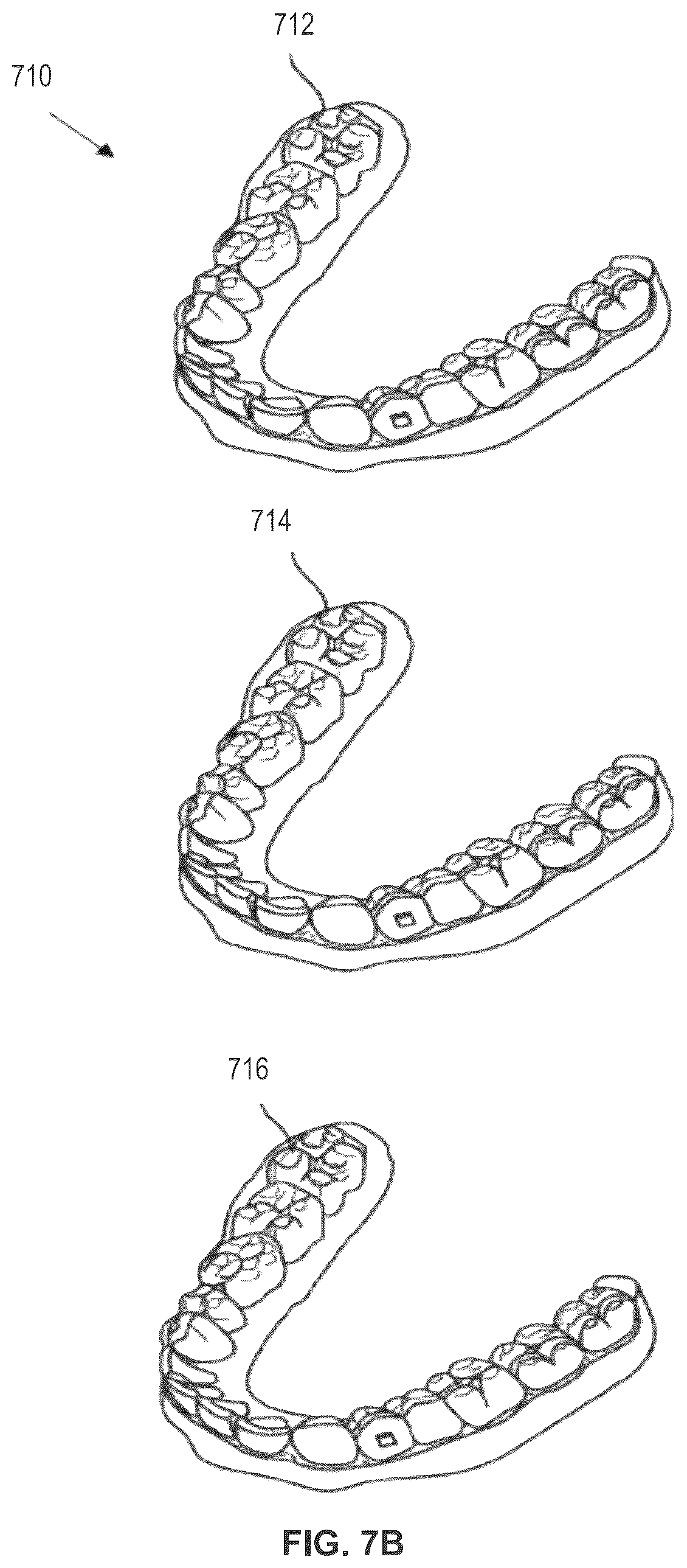 Patent US12583170 Figure 16 – Aligner manufacturing methods