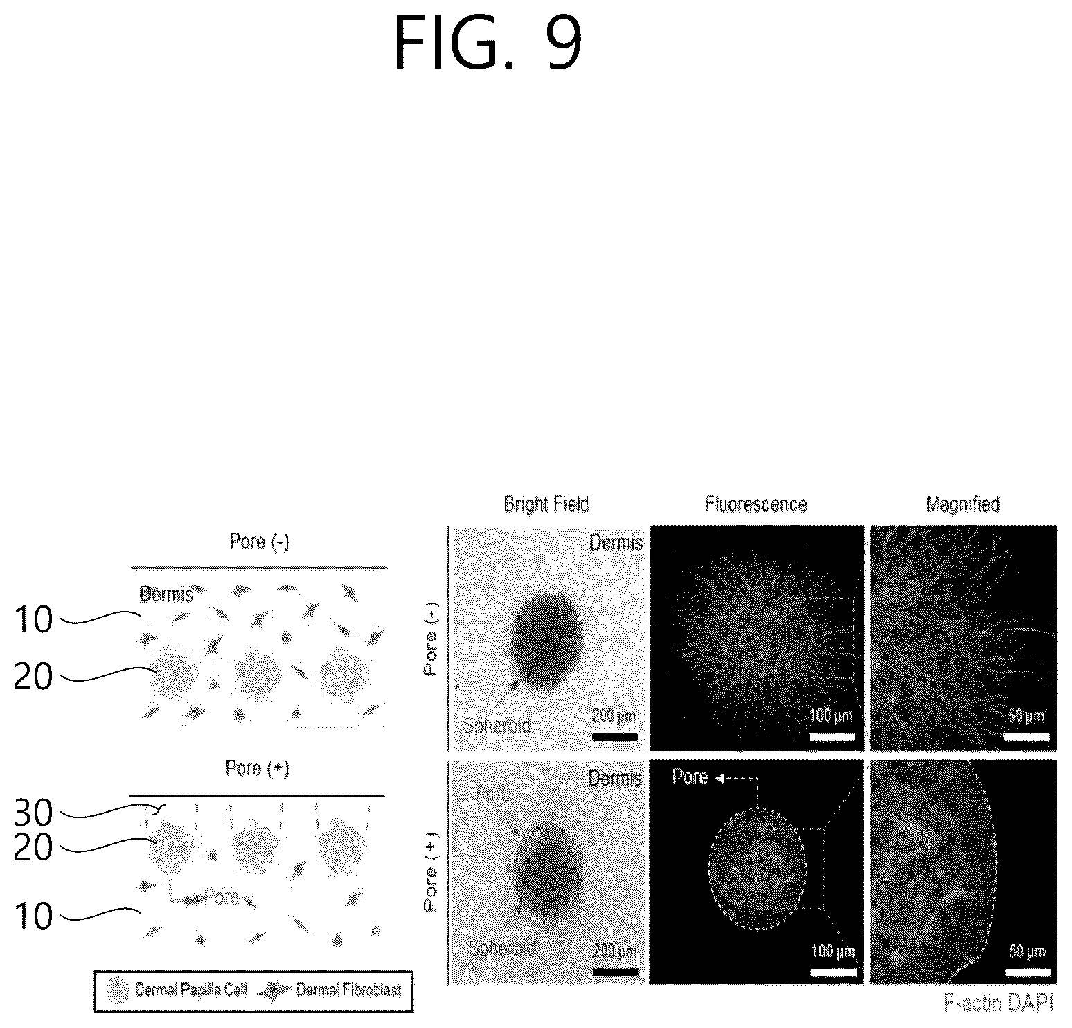 Patent US12583172 Figure 15 – Artificial scalp model production method using 3D printing-based multi-point multi-nozzles and artificial scalp model created by using same
