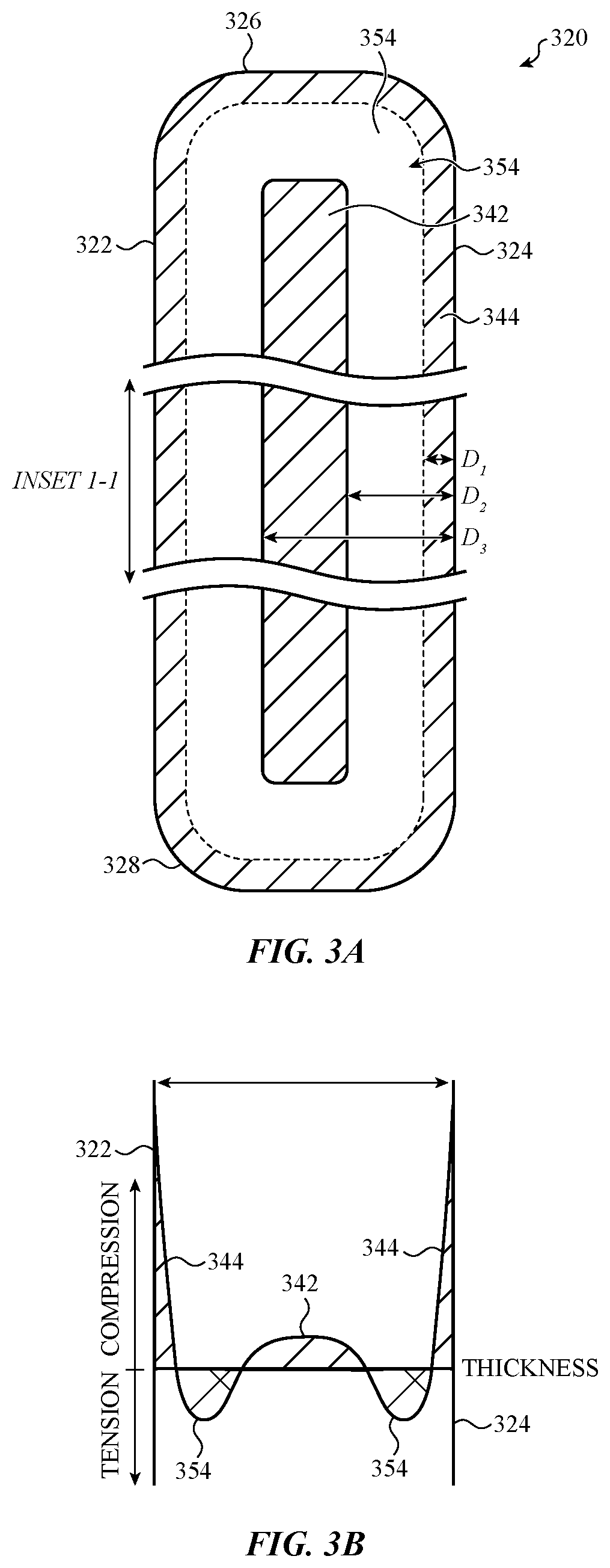 Patent US12583206 Figure 4 – Electronic device having a glass component with crack hindering internal stress regions