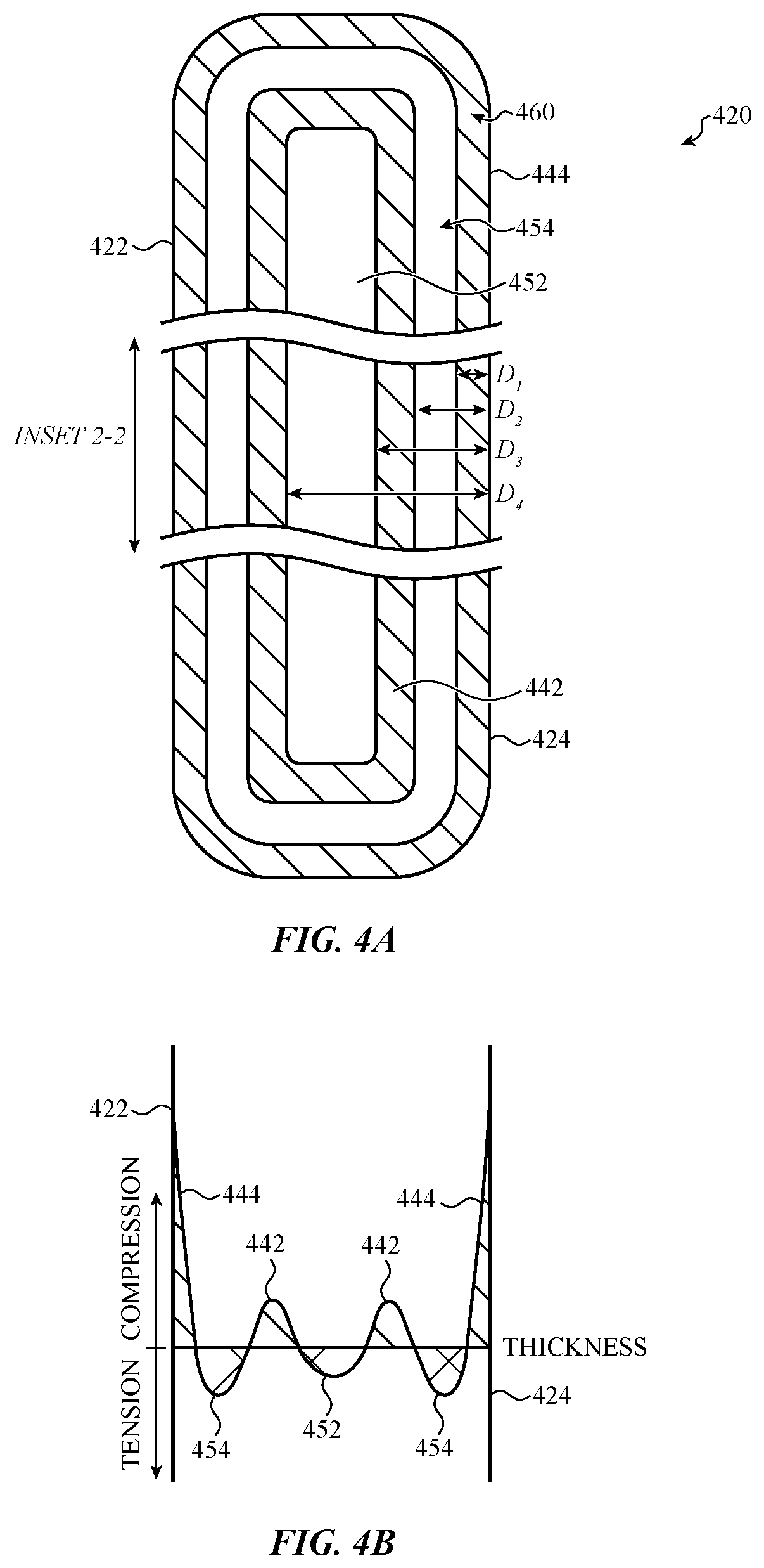 Patent US12583206 Figure 6 – Electronic device having a glass component with crack hindering internal stress regions