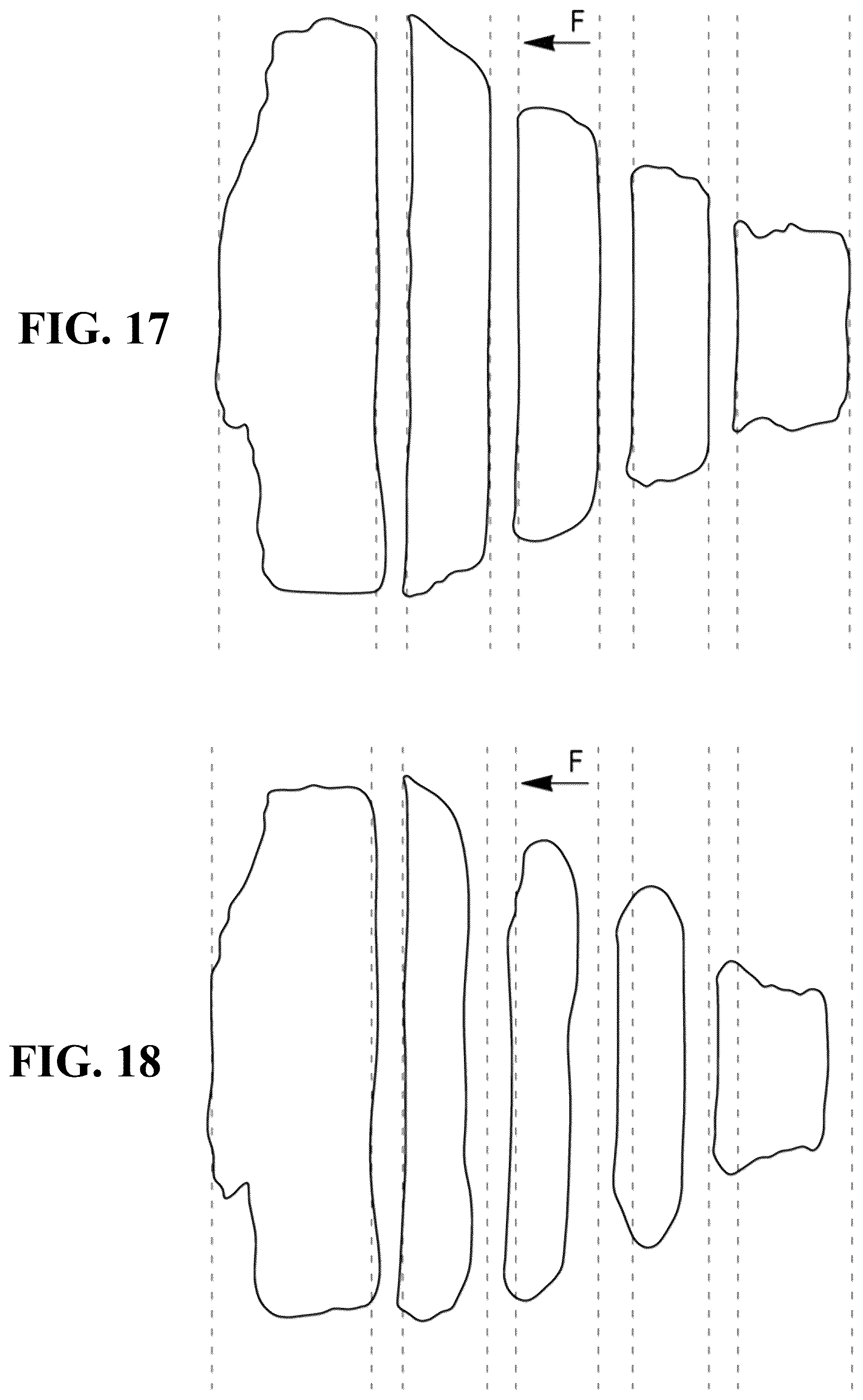 Patent US12583258 Figure 12 – Tire comprising a durable stiffening structure and allowing proper flattening