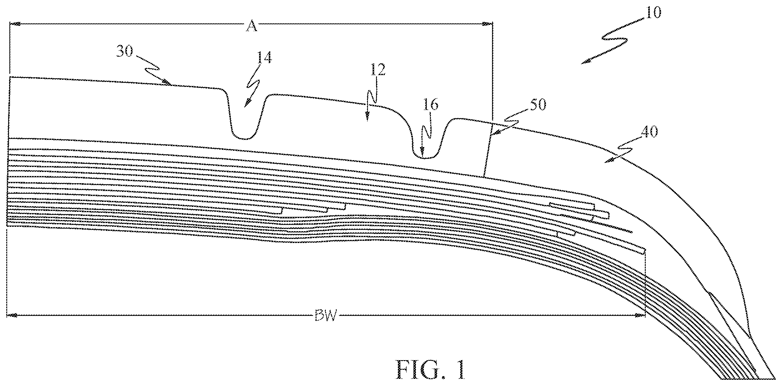 Patent US12583261 — Aircraft tire with zoned tread — Figure 1