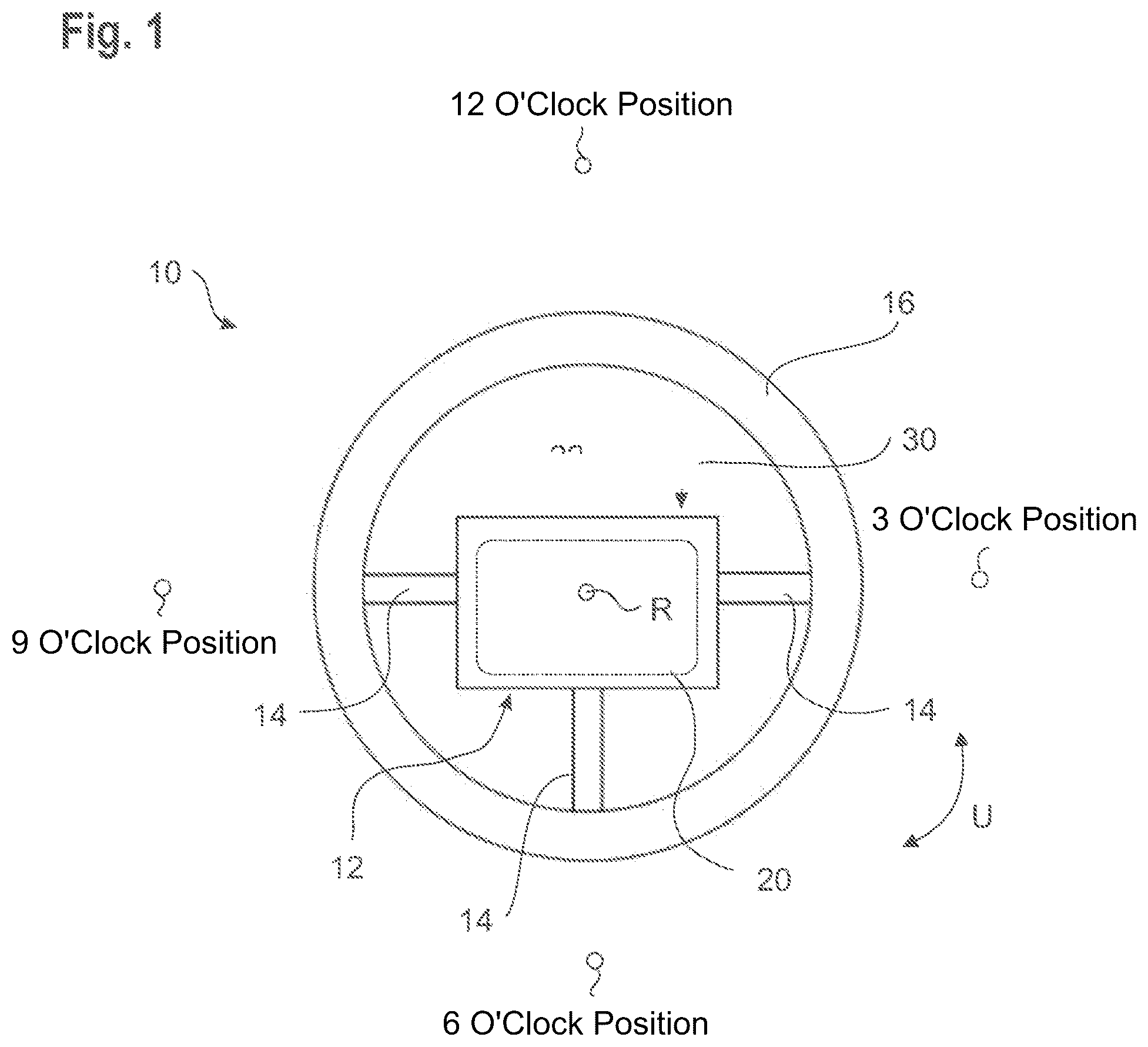 Patent US12583408 Figure 1 – Steering wheel with an airbag