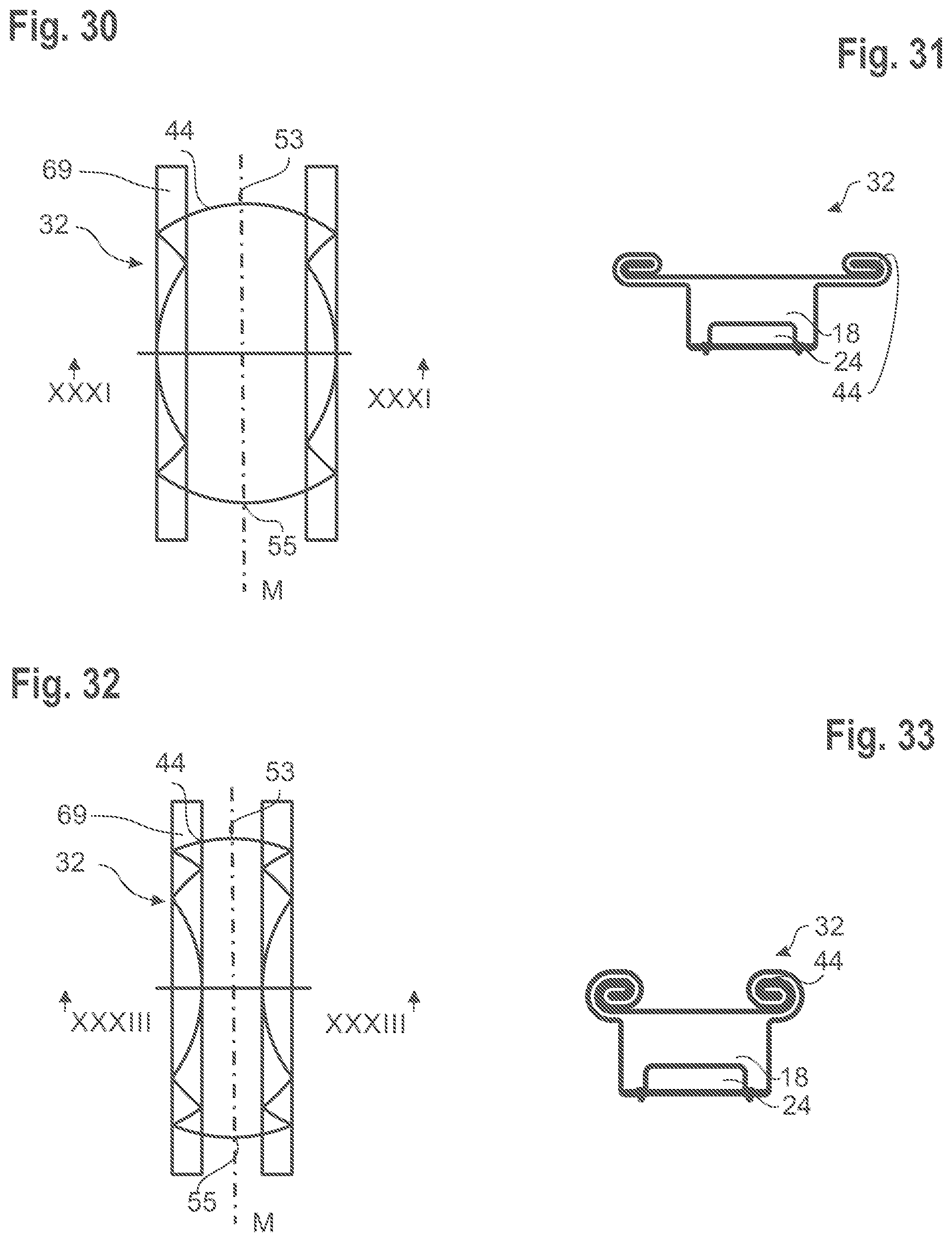 Patent US12583408 Figure 14 – Steering wheel with an airbag